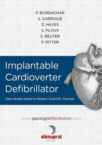 Implantable Cardioverter Defibrillator