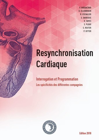 S.E.D.D. Resynchronisation Cardiaque