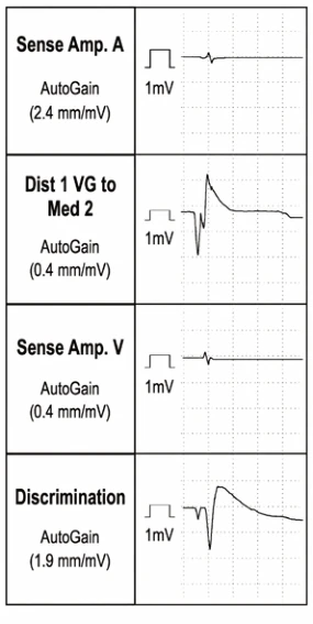 Operating principles, specific features of the Gallant platform