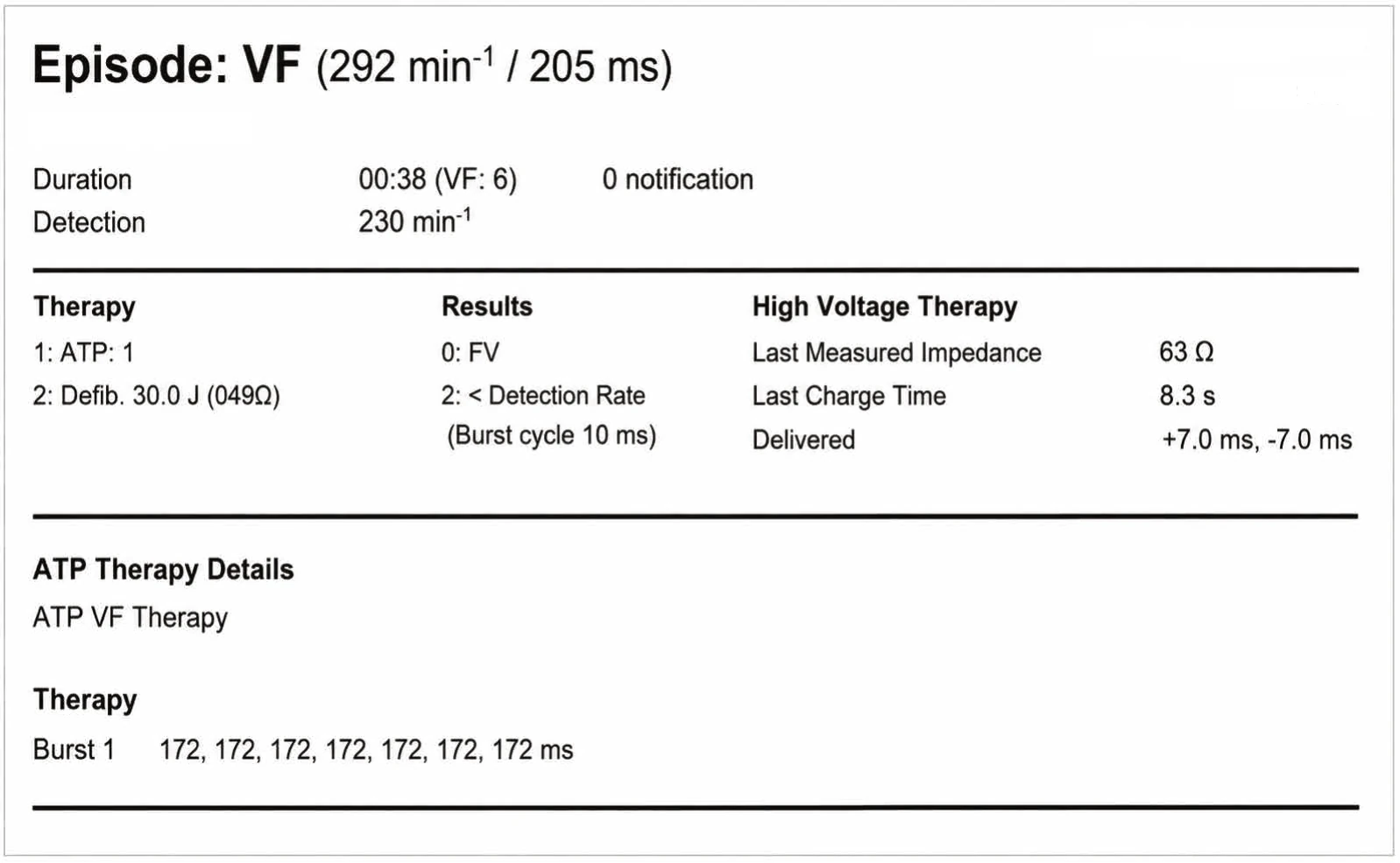 Classification of cycles and ventricular undersensing during an episode of VF