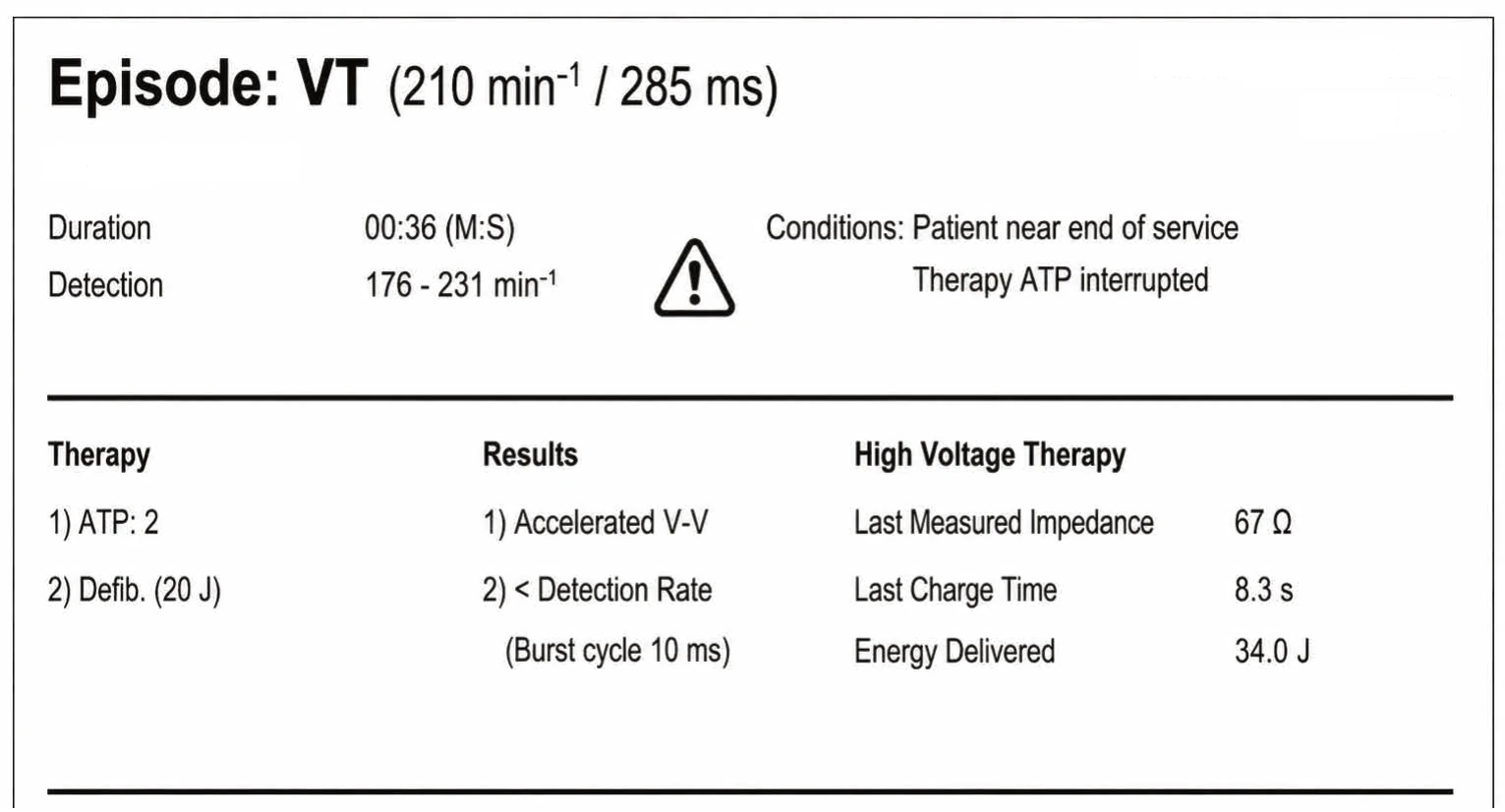Redetection counter after acceleration of VT in the VF zone