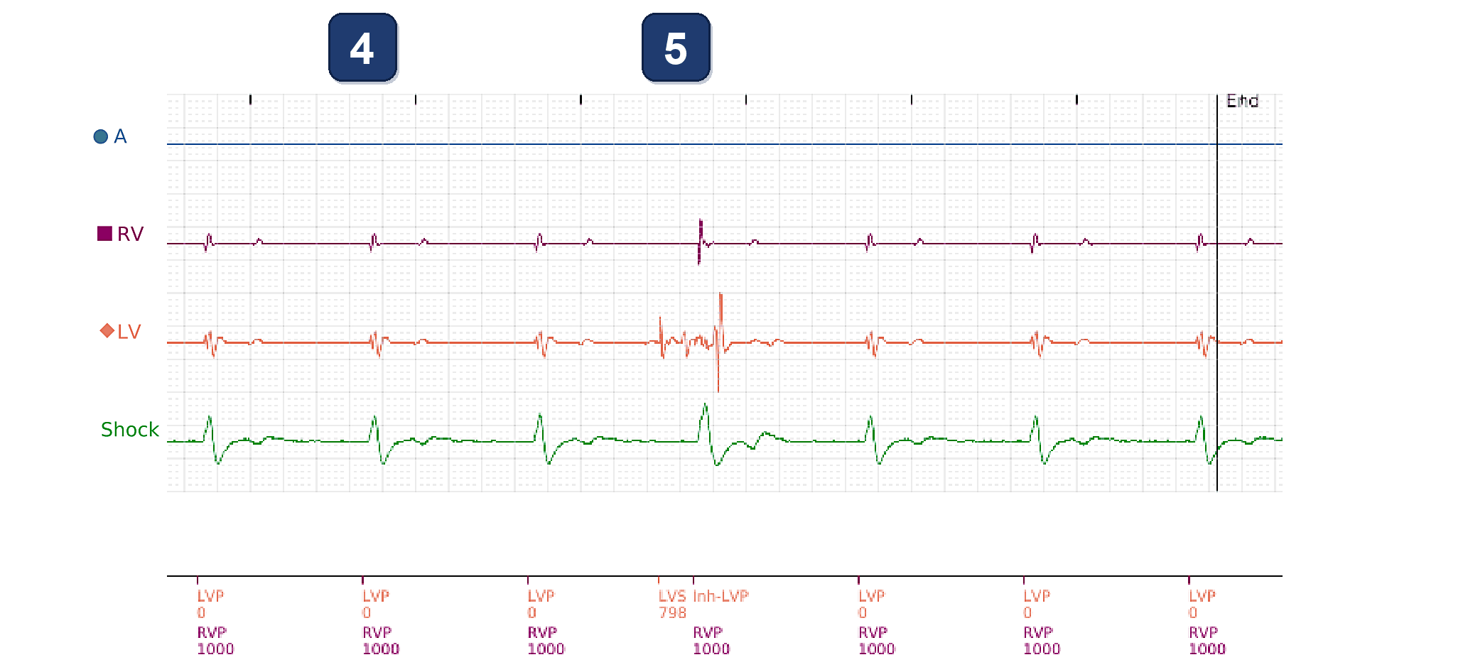 Boston Scientific CRT electrogram, segment 2/4 — LV impedance alert and an odd PaceSafe LV test