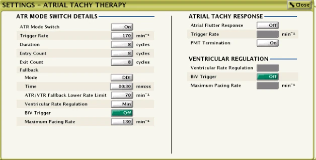 Programmer screen, Settings – Atrial Tachy Therapy (an example, not this patient’s settings): Ventricular Rate Regulation (VRR) and BiV Trigger are programmed separately for ATR fallback (left) and for normal mode (right, Ventricular Regulation), each with its own maximum pacing rate