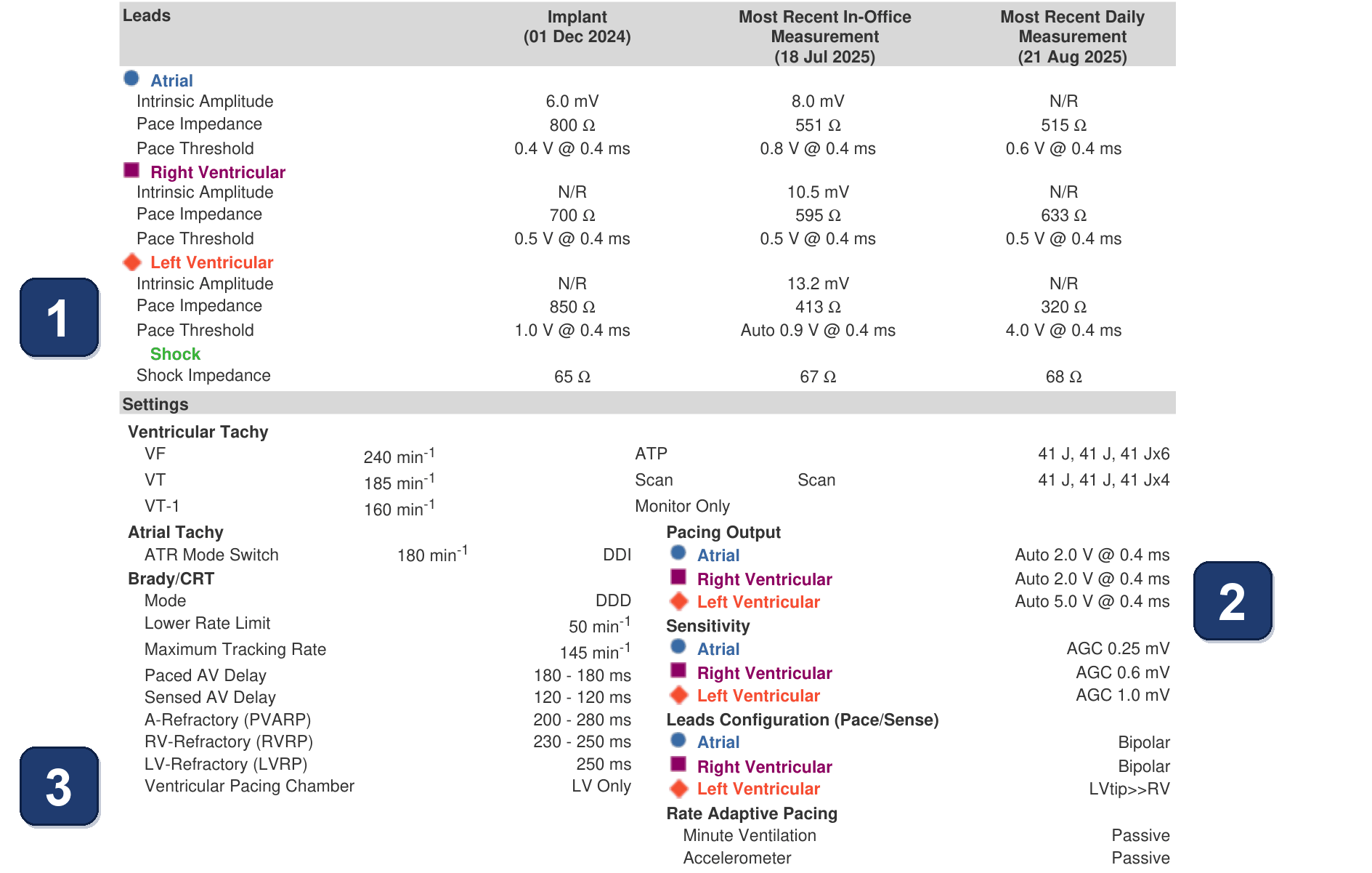 Boston Scientific CRT electrogram, segment 1/3 — CRT-D with a conduction-system lead: the LV trends jump