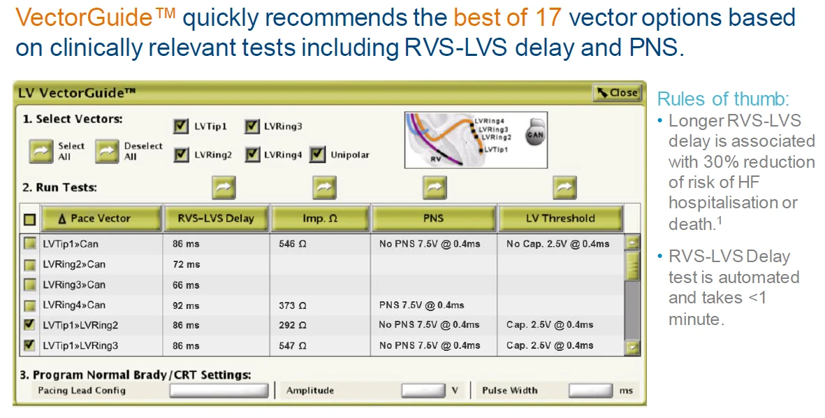 VectorGuide (Boston Scientific programmer) tests the vectors of a quadripolar LV lead: RVS-LVS delay, impedance, phrenic nerve stimulation (PNS) and LV threshold for each one. Every vector has its own impedance: 292 to 547 Ω in this example, where LVTip1>>LVRing2 measures less than LVRing4>>Can; in this patient it measures about three times more