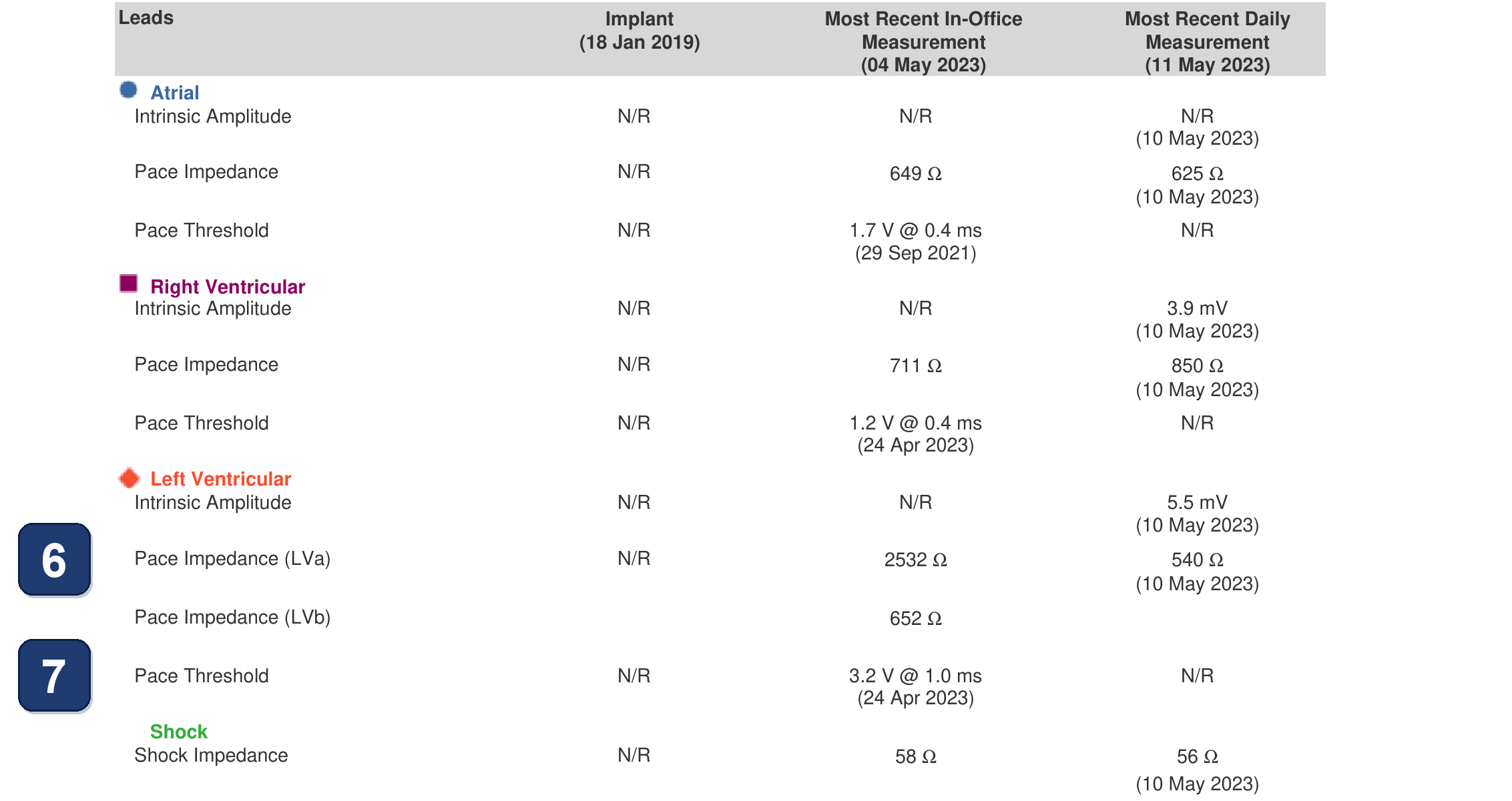 Boston Scientific CRT electrogram, segment 4/5 — Extra LV sensed events in a CRT-D programmed VVI 40