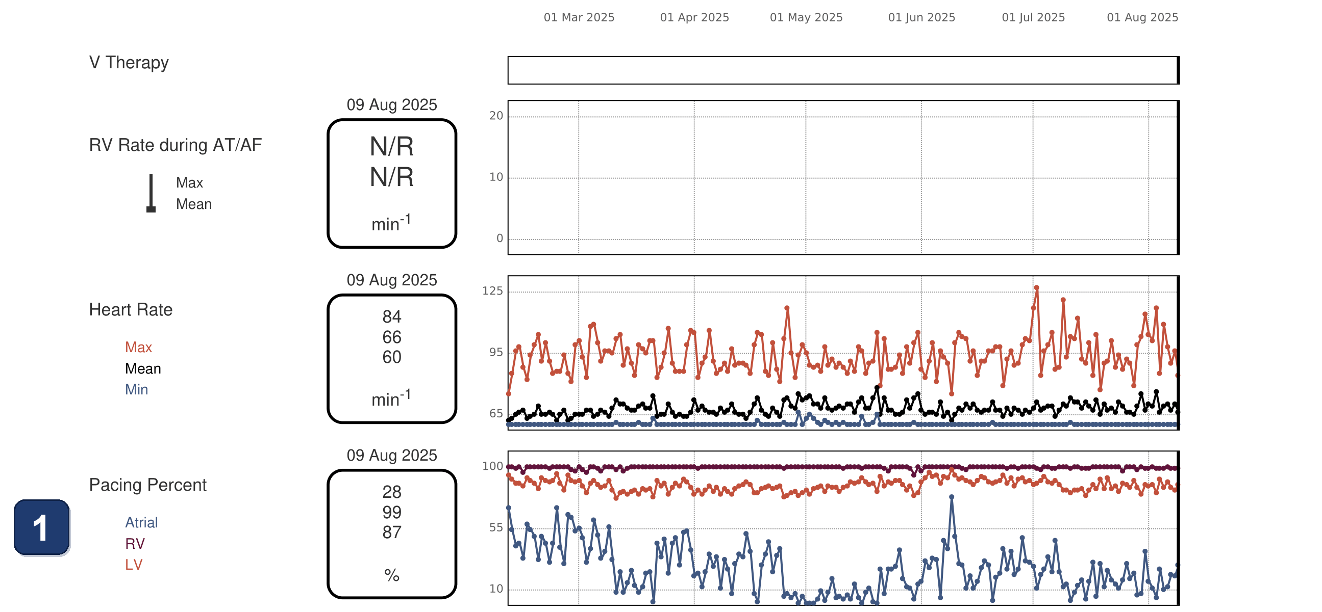 Boston Scientific CRT electrogram, segment 1/3 — Intermittent loss of LV pacing despite 99% RV pacing
