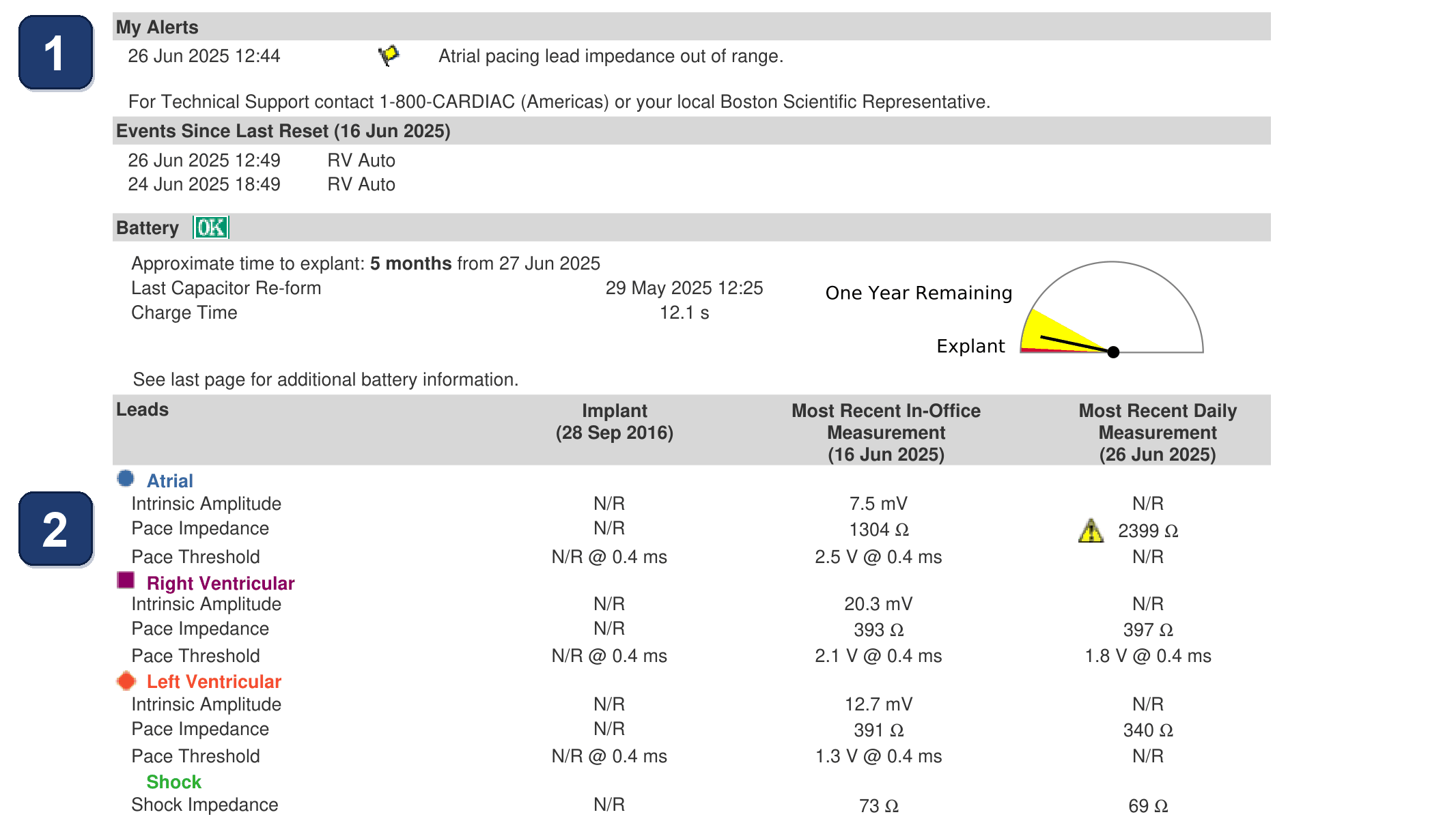 Boston Scientific CRT electrogram, segment 1/3 — RA lead impedance alert in a paced CRT patient