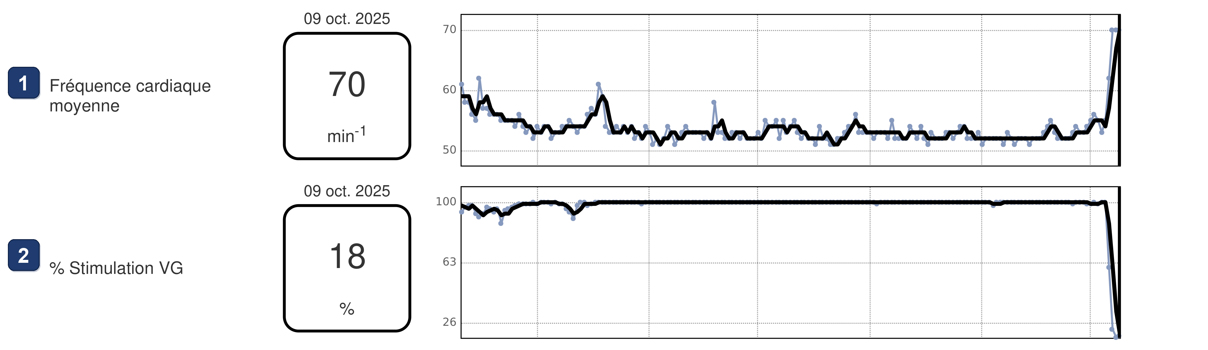 Boston Scientific CRT electrogram, segment 1/4 — CRT loss at rest with sinus bradycardia