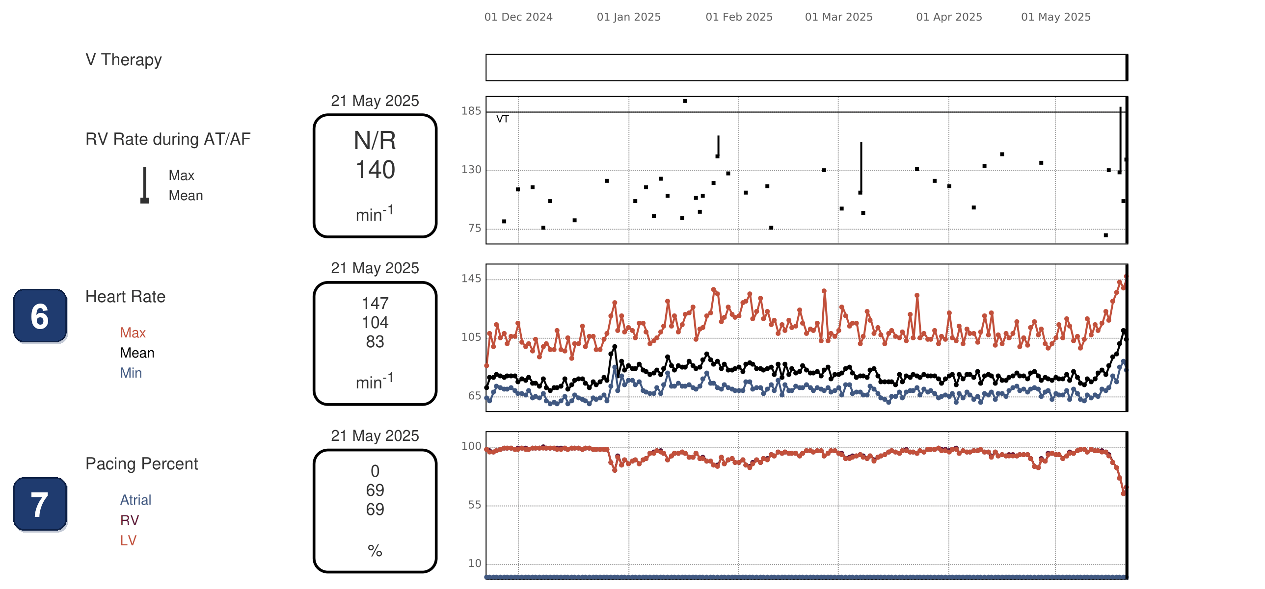 Boston Scientific CRT electrogram, segment 2/4 — CRT drop in a patient with atrial ectopy