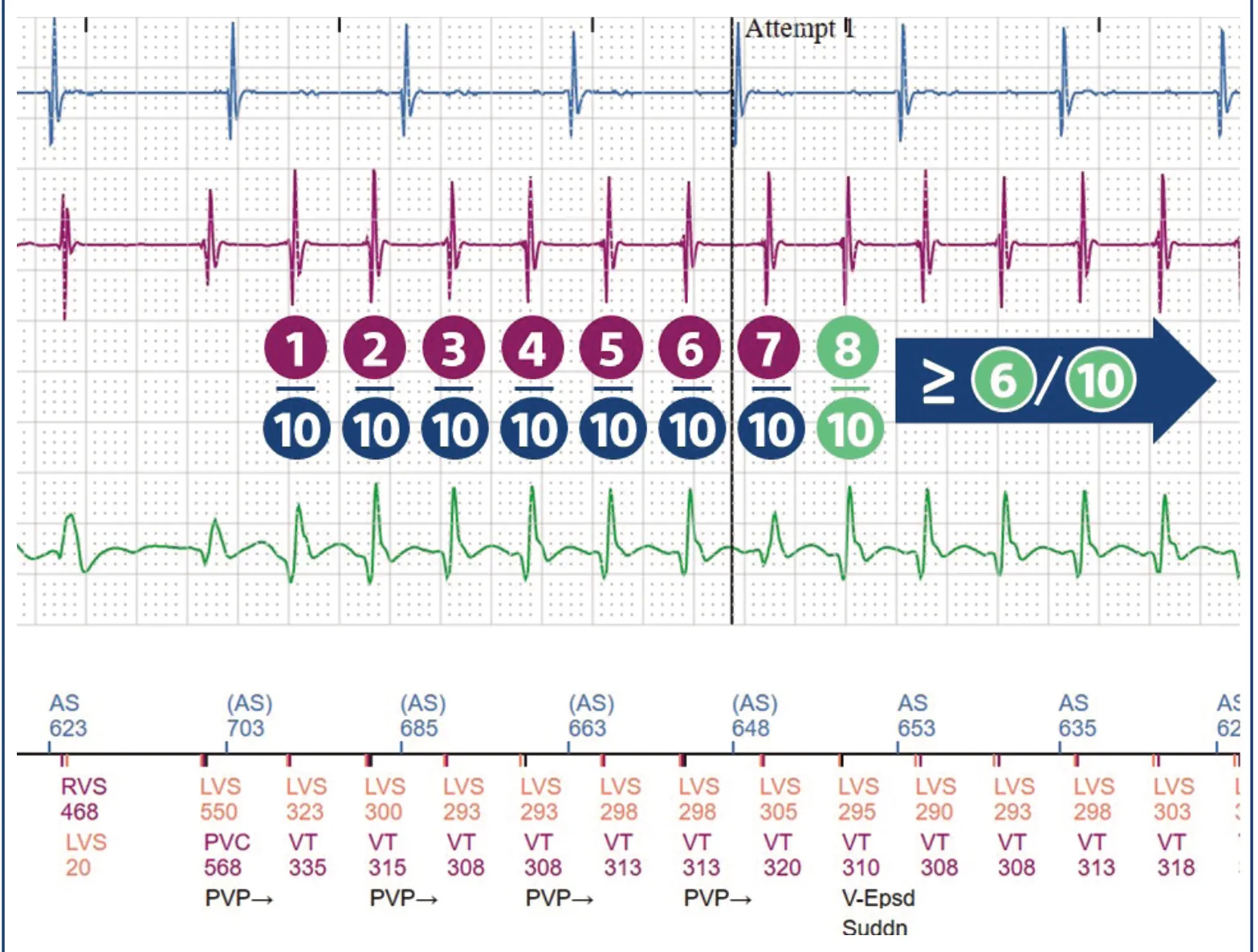 This figure shows the different counters: initial detection of 8/10 with marker (V-Epsd), then initial duration with rolling window and 6/10 counter.