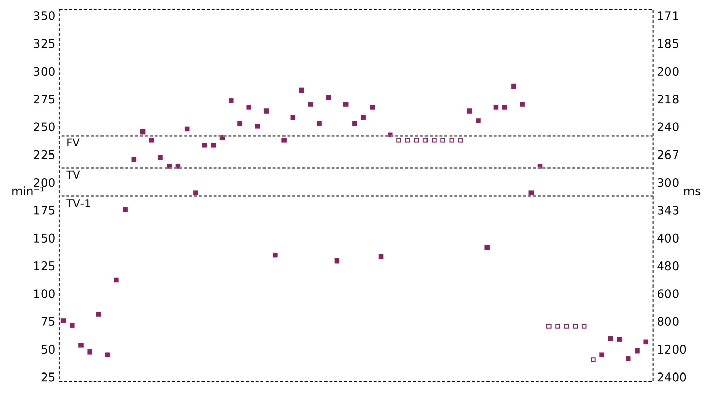 Interval plot — Spontaneous termination and shock diversion