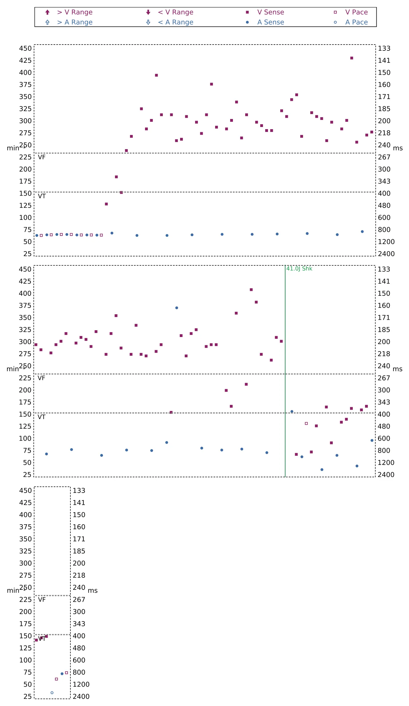Interval plot — VF episode correctly detected and treated with maximum output shock