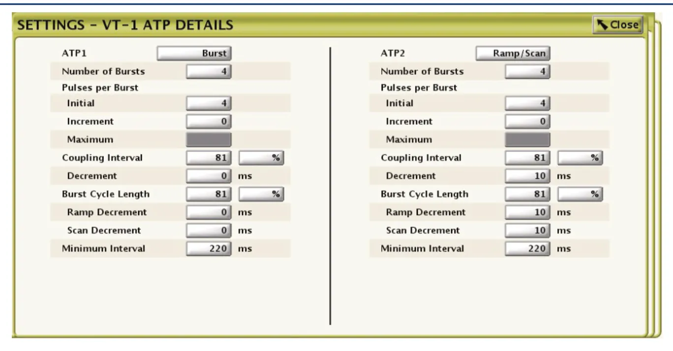 This figure shows the various programming options for optimizing the effectiveness of the anti-tachycardia pacing sequence(s).