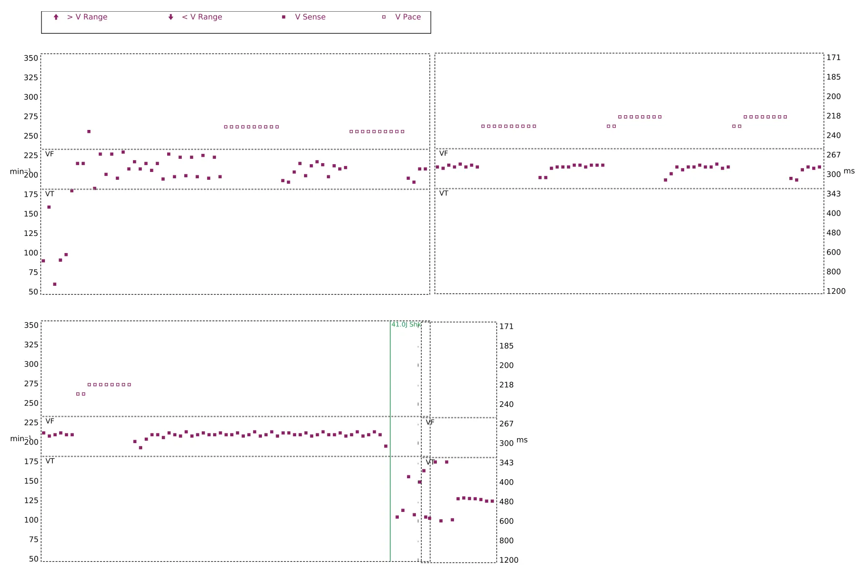 Interval plot — Maximum output shock in the VT zone