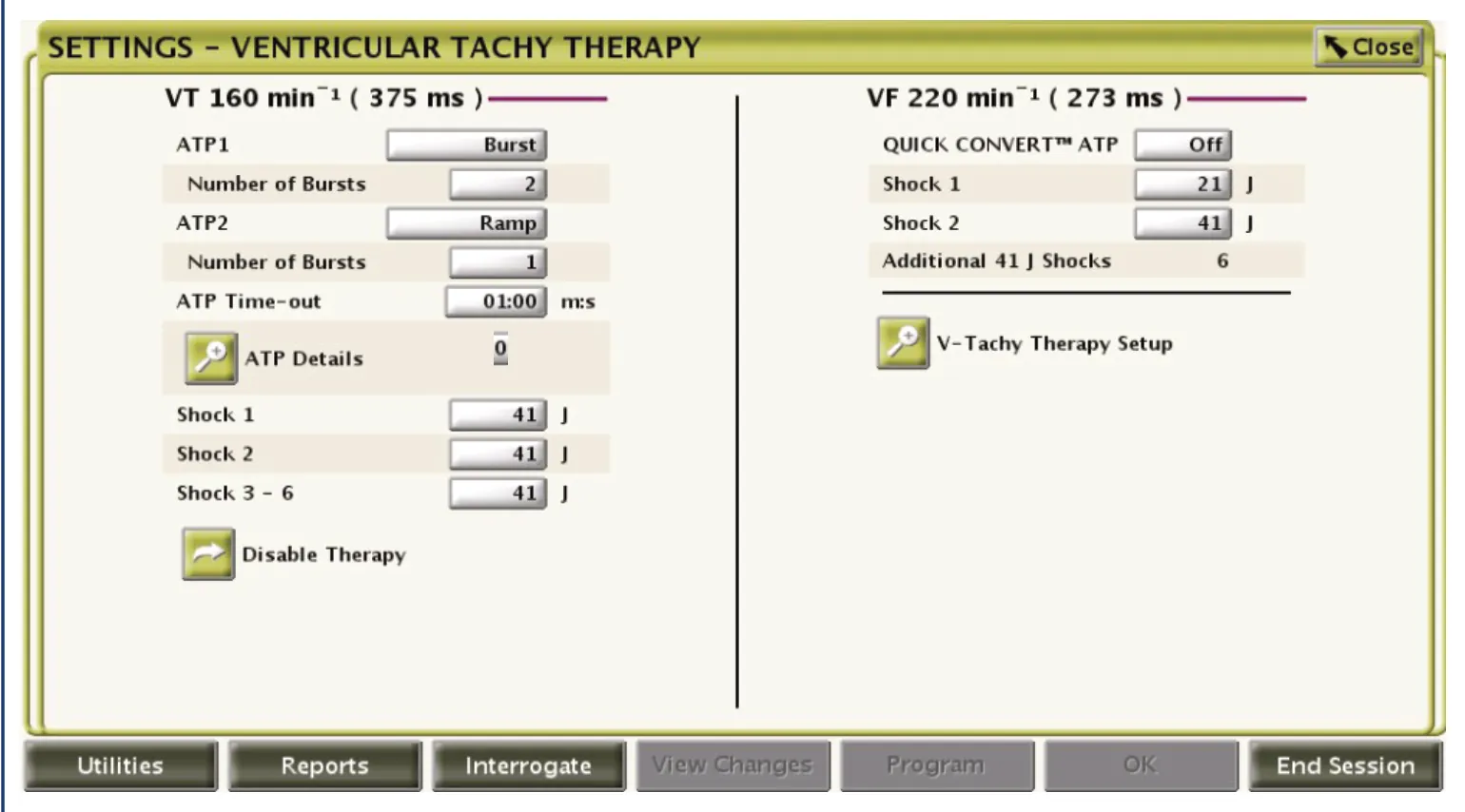 Example of programming in the VT zone with therapies of increasing aggressiveness; burst then ramp then shock (maximum amplitude from the outset); 8 shocks can be programmed for the VF zone, 6 shocks for the VT zone and 5 shocks for the VT-1 zone.