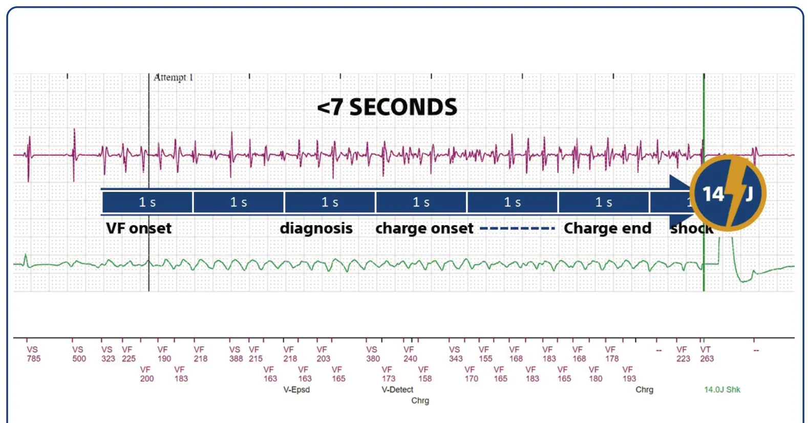 This figure shows the time interval in this young patient between the onset of arrhythmia and the moment when the shock is delivered; this interval is broken down into 8/10 criteria, initial duration in the VF zone, capacitor charging, confirmation at the end of charging, etc.