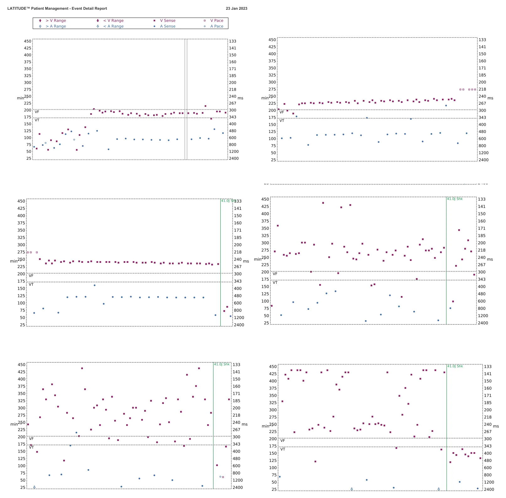 Interval plot — VT in the VF zone and high defibrillation threshold