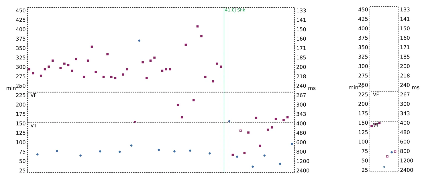 Interval plot — Single-chamber discrimination, Rhythm ID and a ventricular tachycardia episode