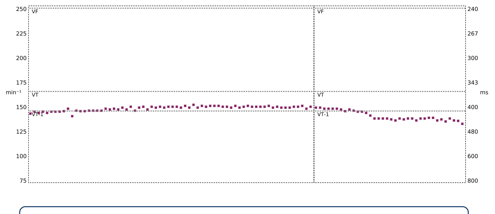 The interval plot corresponding to this episode is highly suggestive of sinus tachycardia, with progressive acceleration of ventricular cycles followed by gradual deceleration.