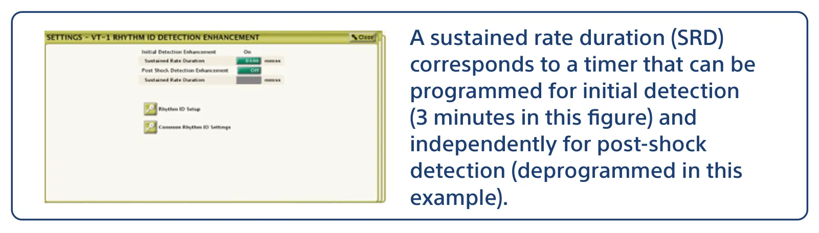 A sustained rate duration (SRD) corresponds to a timer that can be programmed for initial detection (3 minutes in this figure) and independently for post-shock detection (deprogrammed in this example).