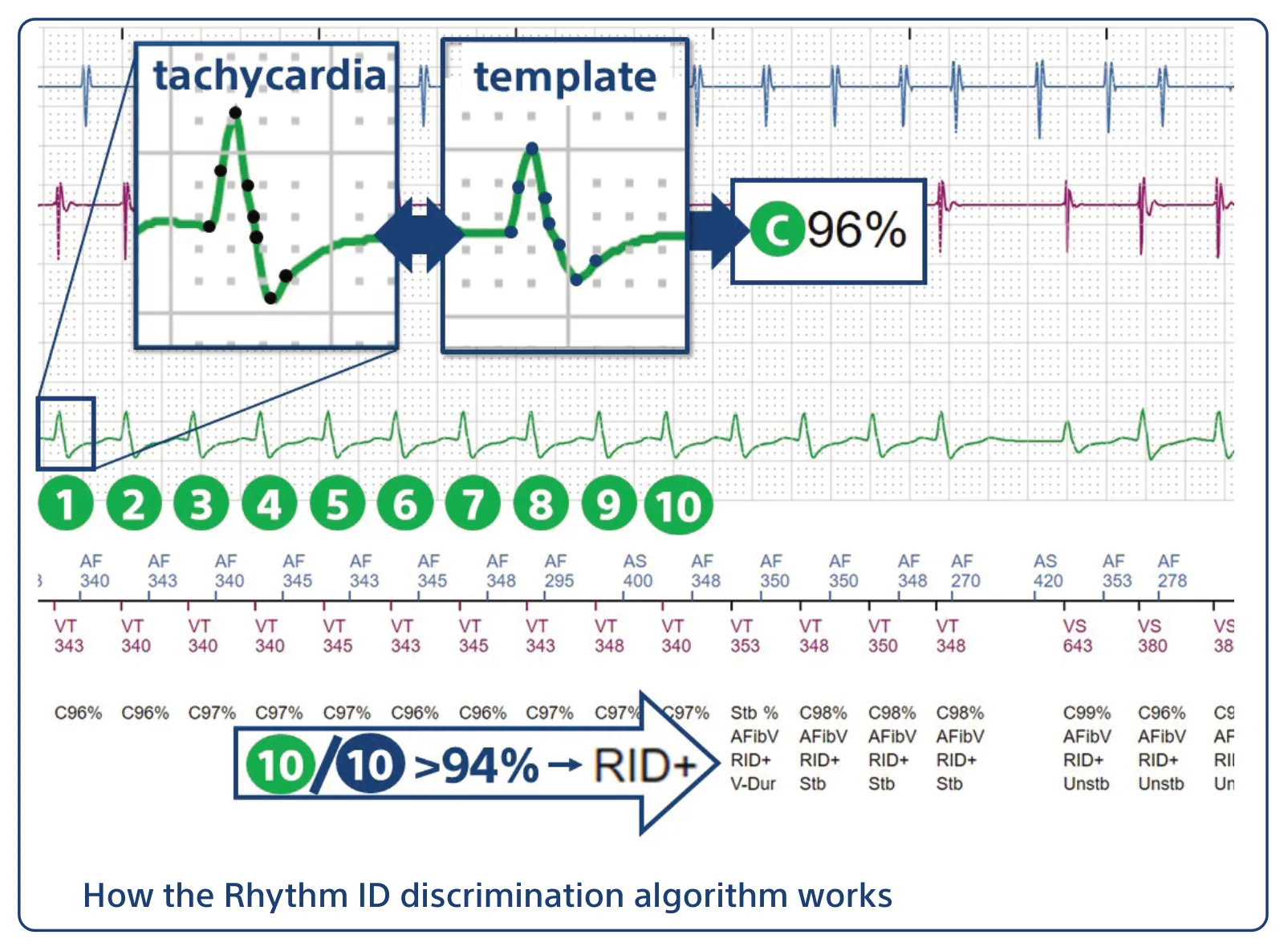How the Rhythm ID discrimination algorithm works