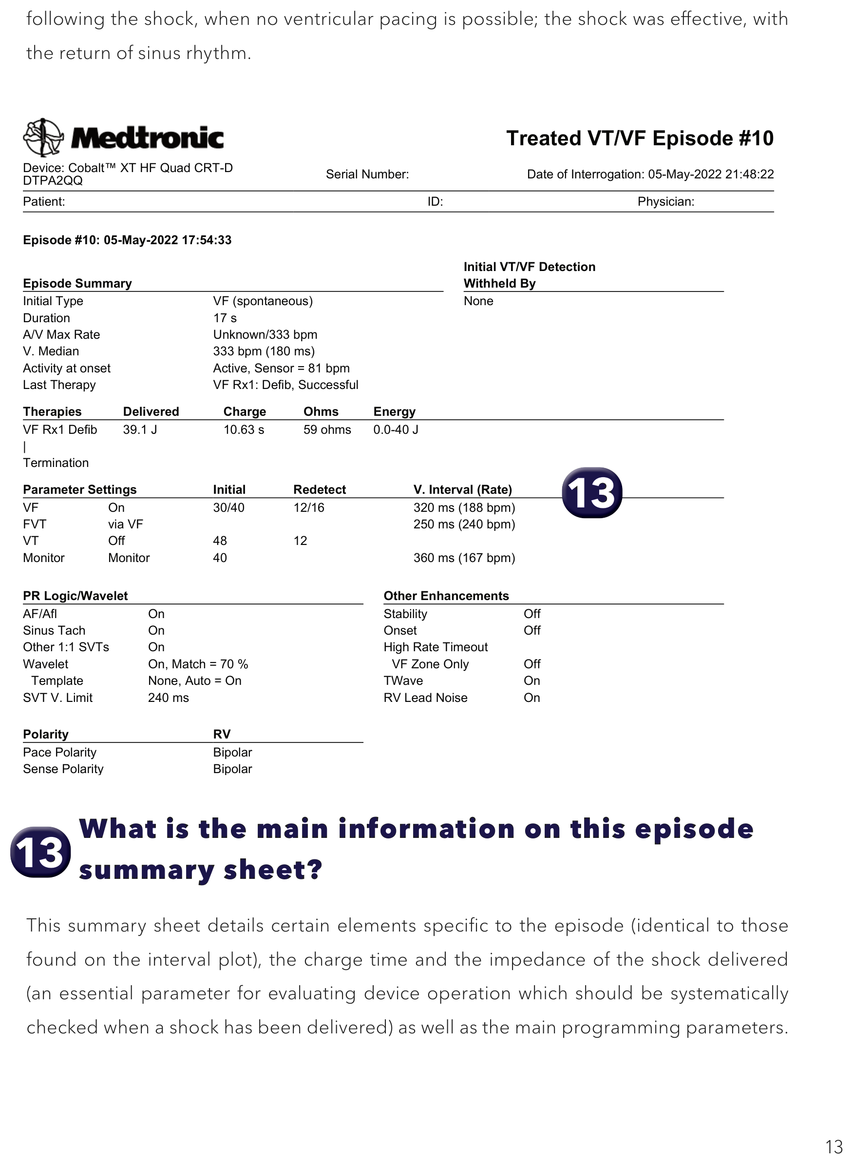 Medtronic ICD electrogram, segment 1 of 1 — Analysis of a VF trace recorded by the device