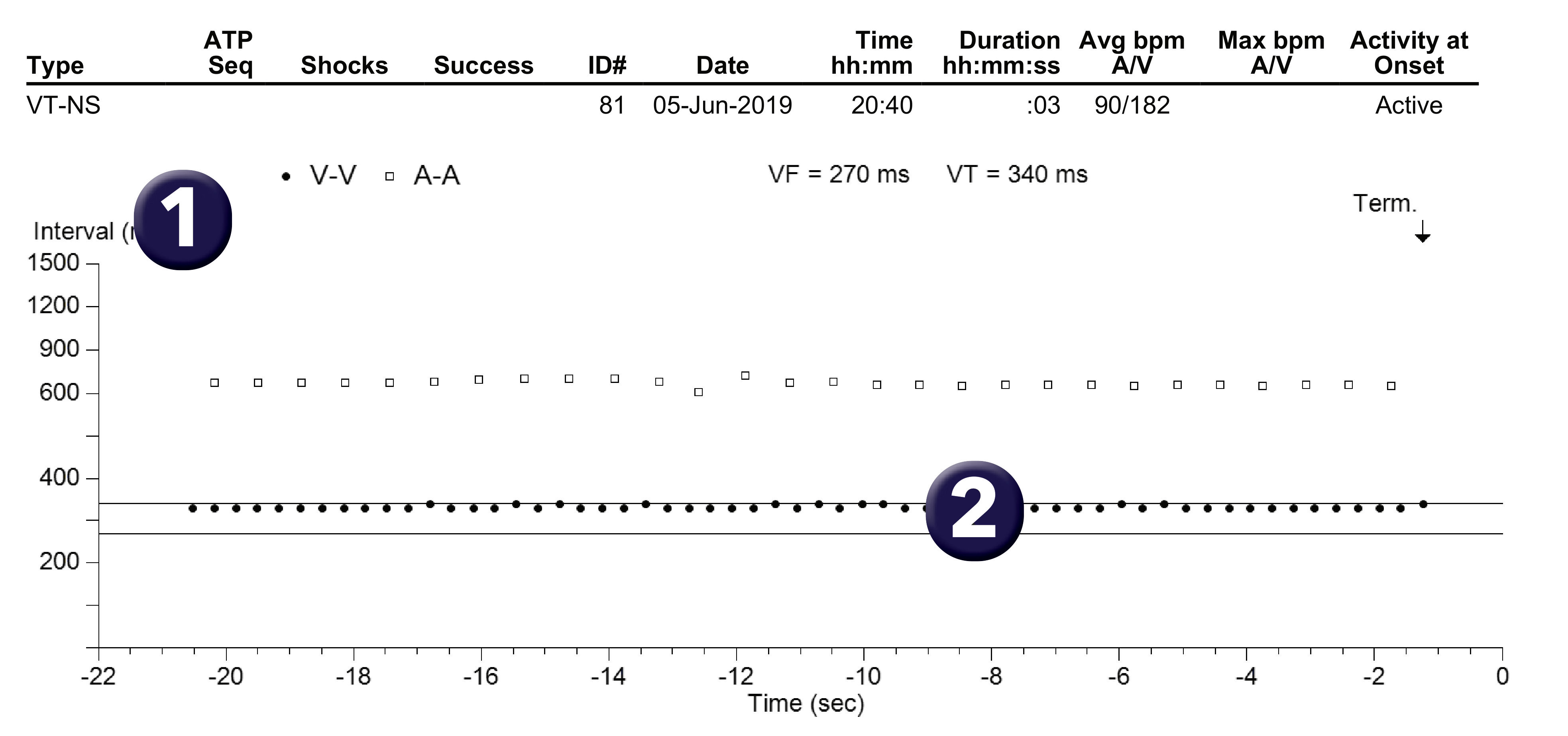 Medtronic ICD electrogram, segment 1 of 1 — Zone limits and the VT counter