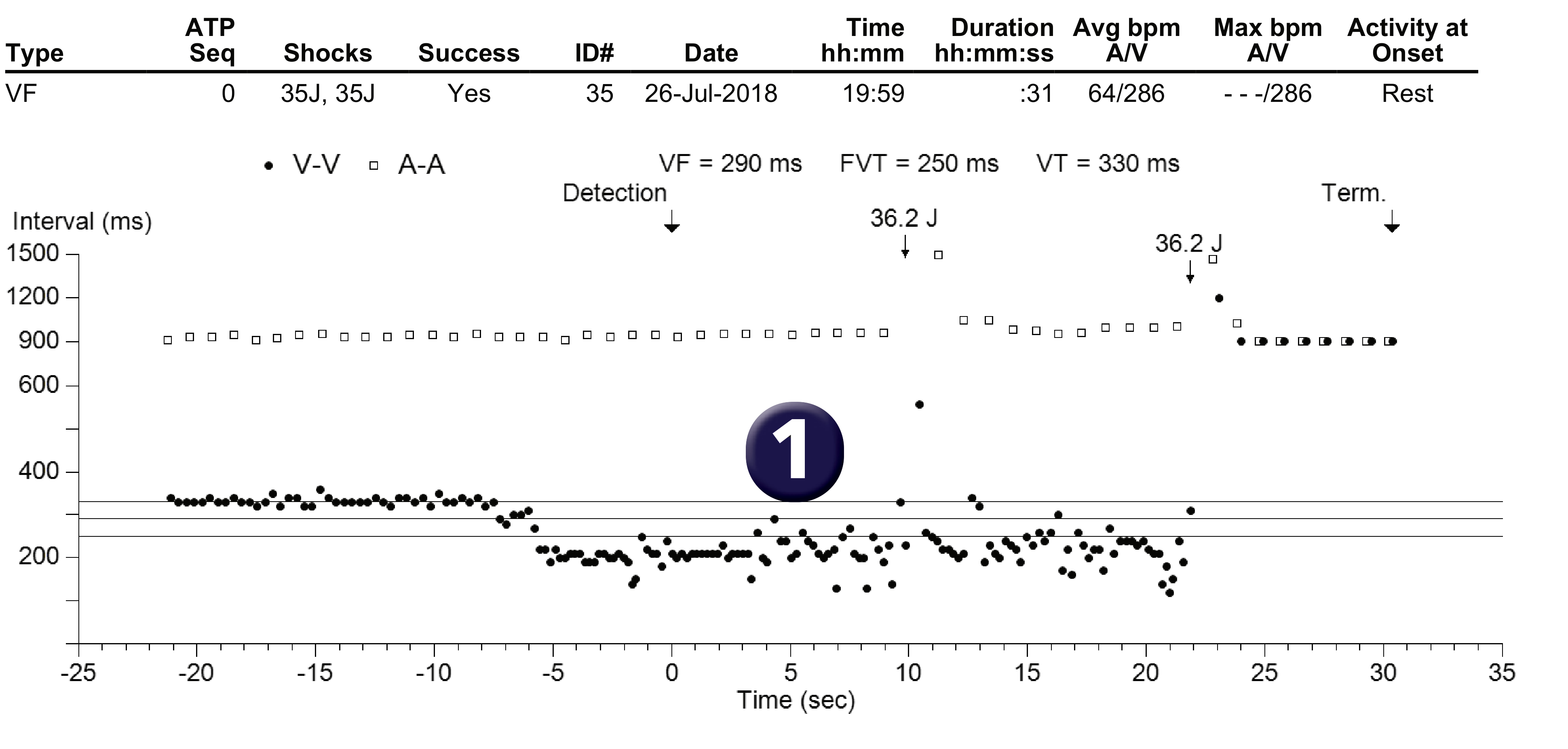 Medtronic ICD electrogram, segment 1 of 1 — Initial counter and redetection counter