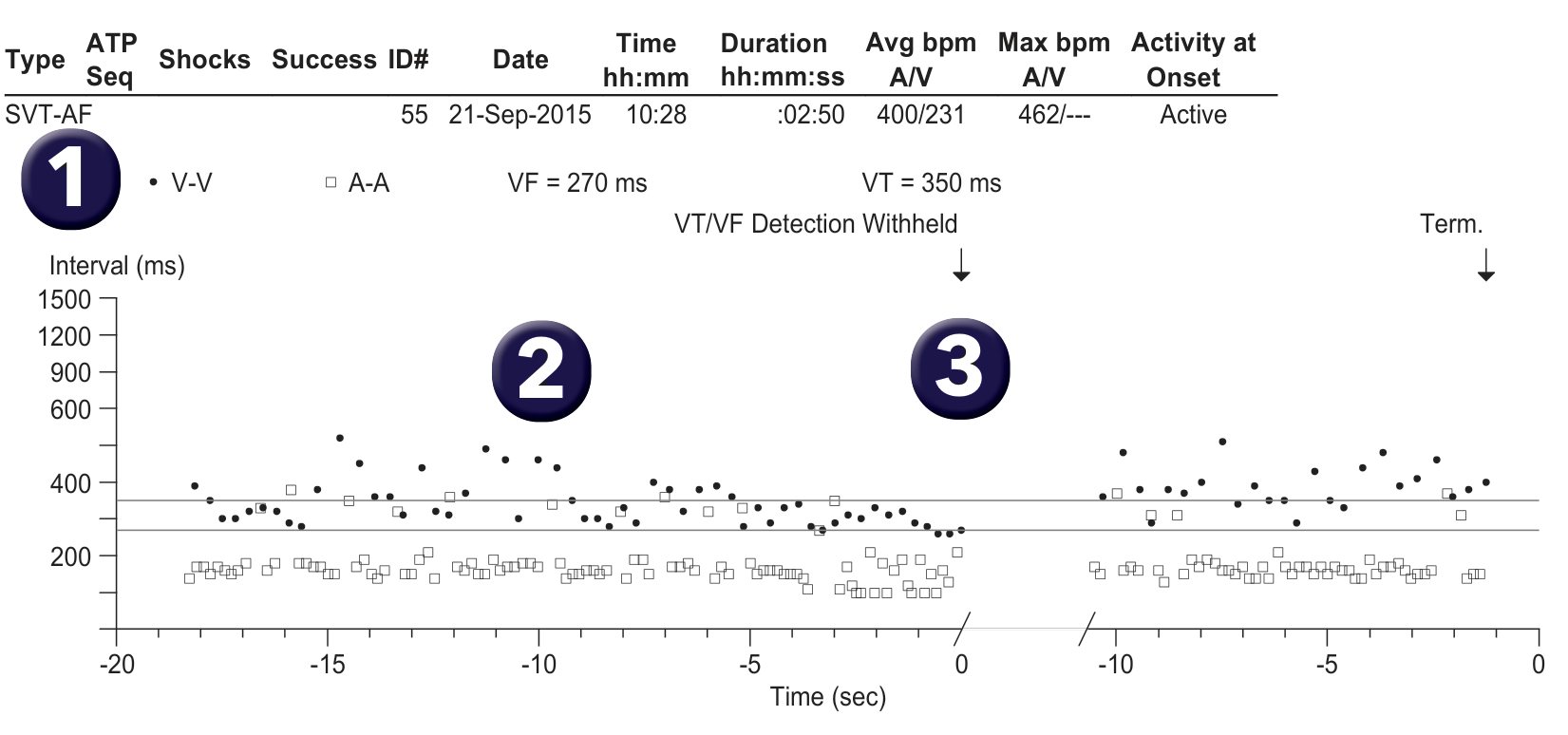Medtronic ICD electrogram, segment 1 of 1 — AF and the VT counter