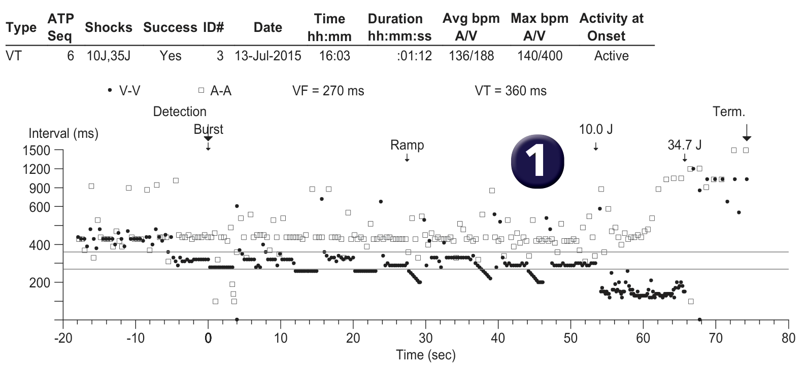 Medtronic ICD electrogram, segment 1 of 1 — Pro-arrhythmogenic effect of a low output shock