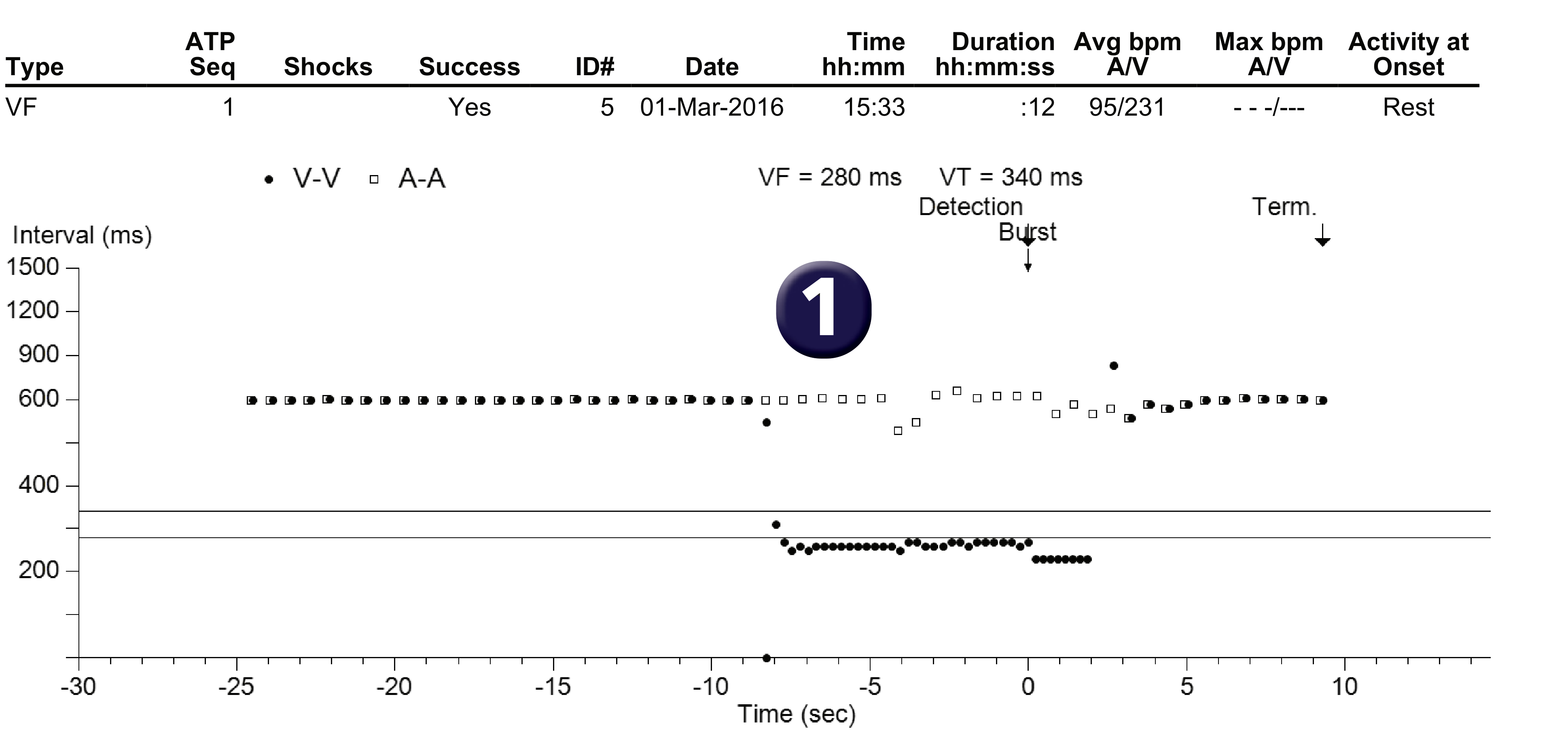 Medtronic ICD electrogram, segment 1 of 1 — Anti-tachycardia pacing in the VF zone