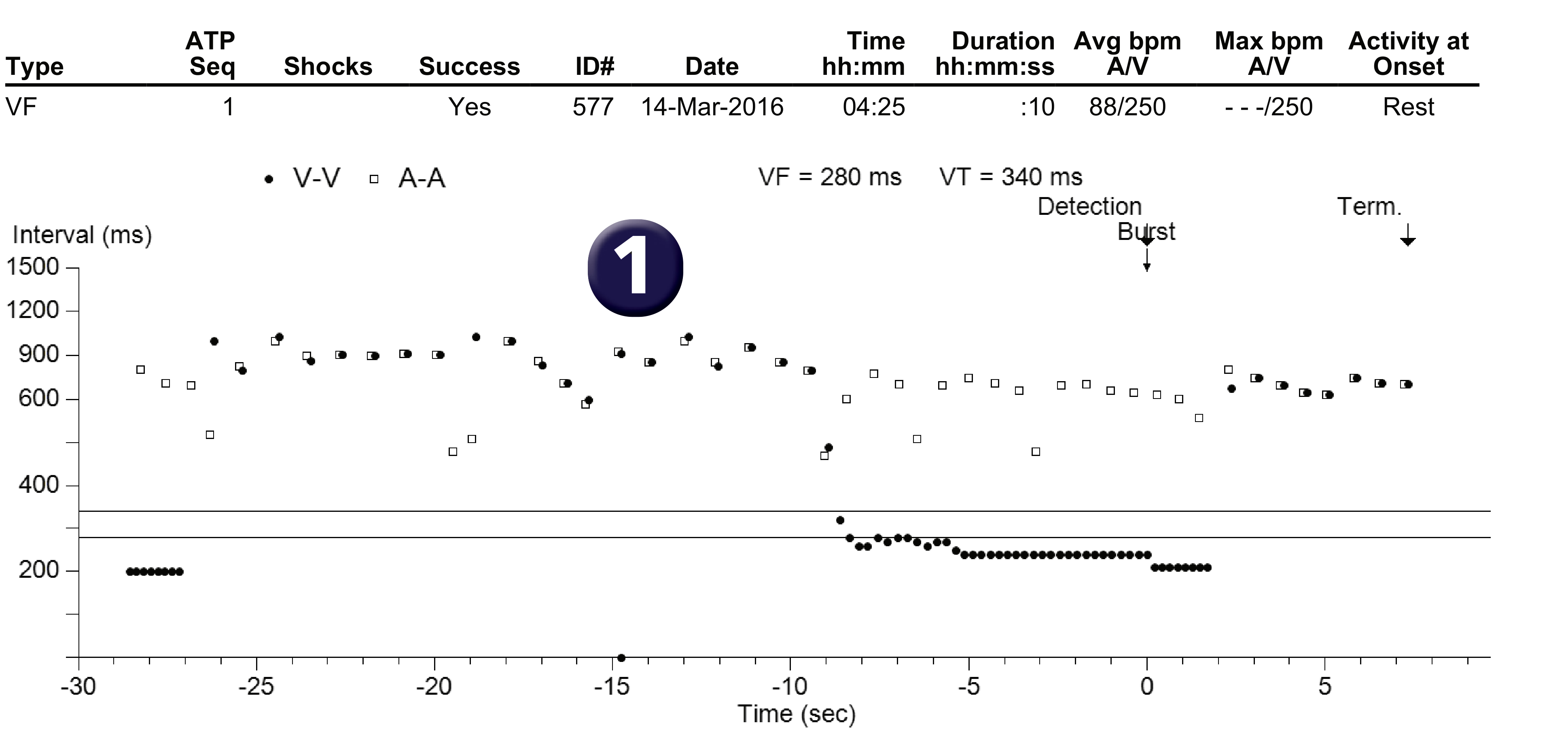 Medtronic ICD electrogram, segment 1 of 1 — Anti-tachycardia pacing in the VF zone and conserving energy