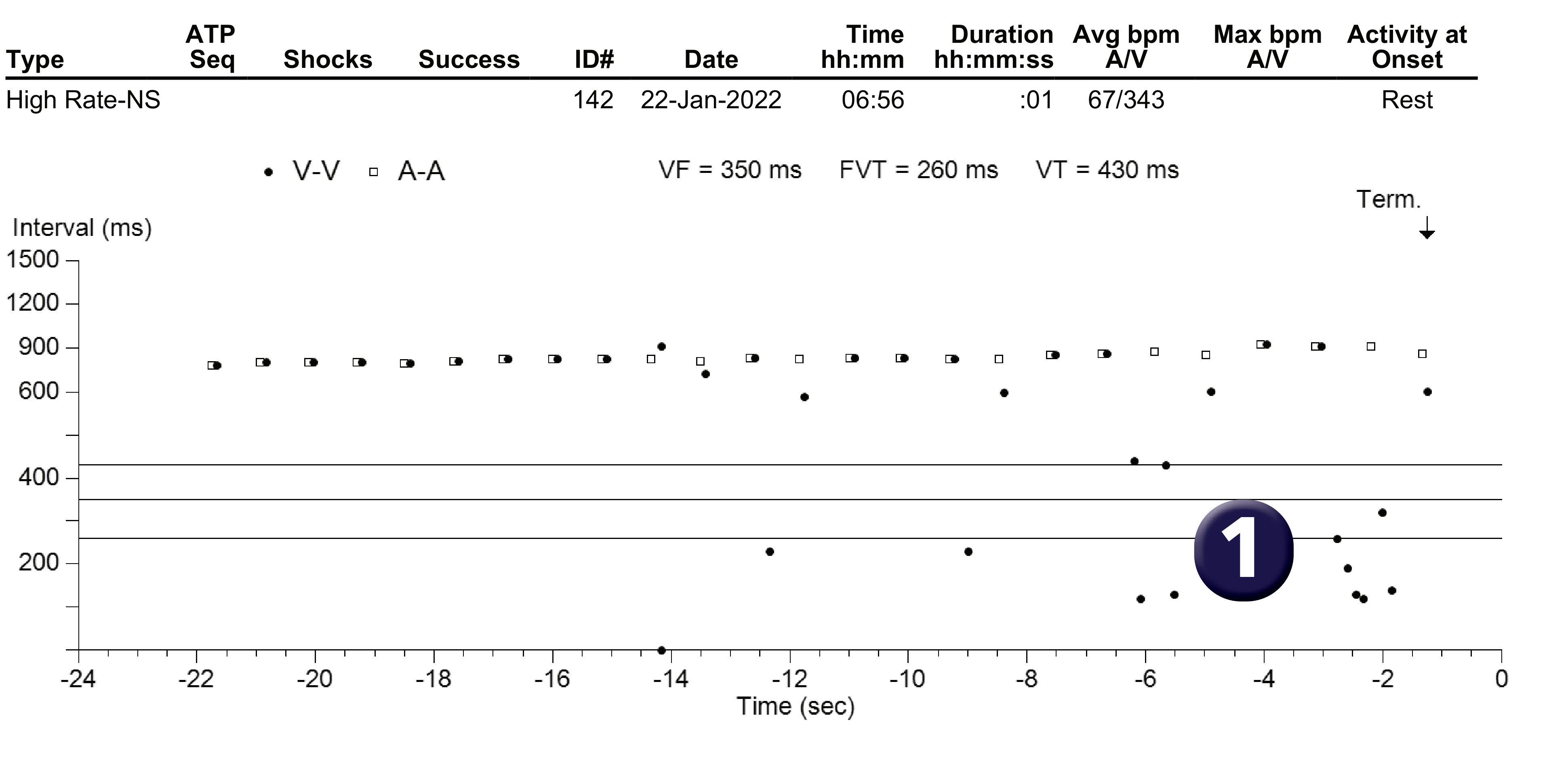 Medtronic ICD electrogram, segment 1 of 1 — Ventricular cycles too short to be physiological
