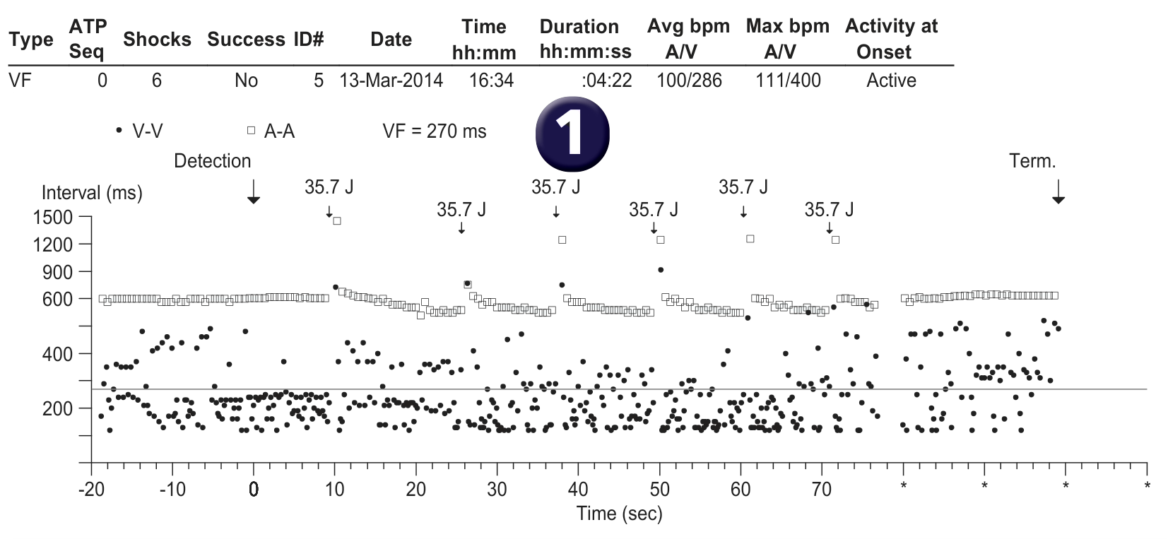 Medtronic ICD electrogram, segment 1 of 1 — Telemedicine monitoring to avoid disasters