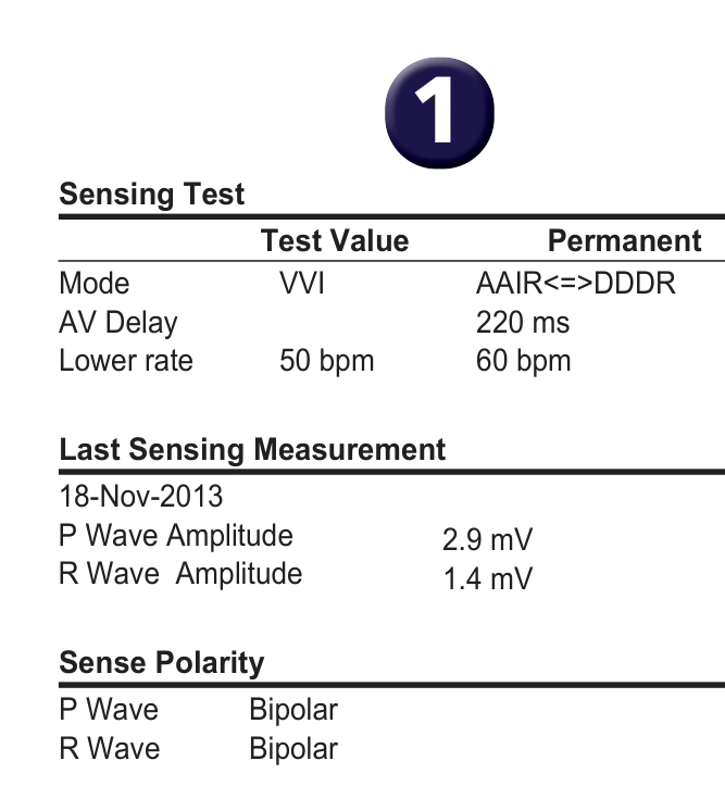 Medtronic ICD electrogram, segment 1 of 2 — Which programming option should be used if the T wave is oversensed?