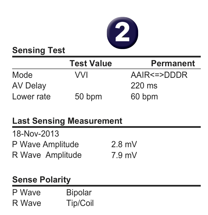 Medtronic ICD electrogram, segment 2 of 2 — Which programming option should be used if the T wave is oversensed?