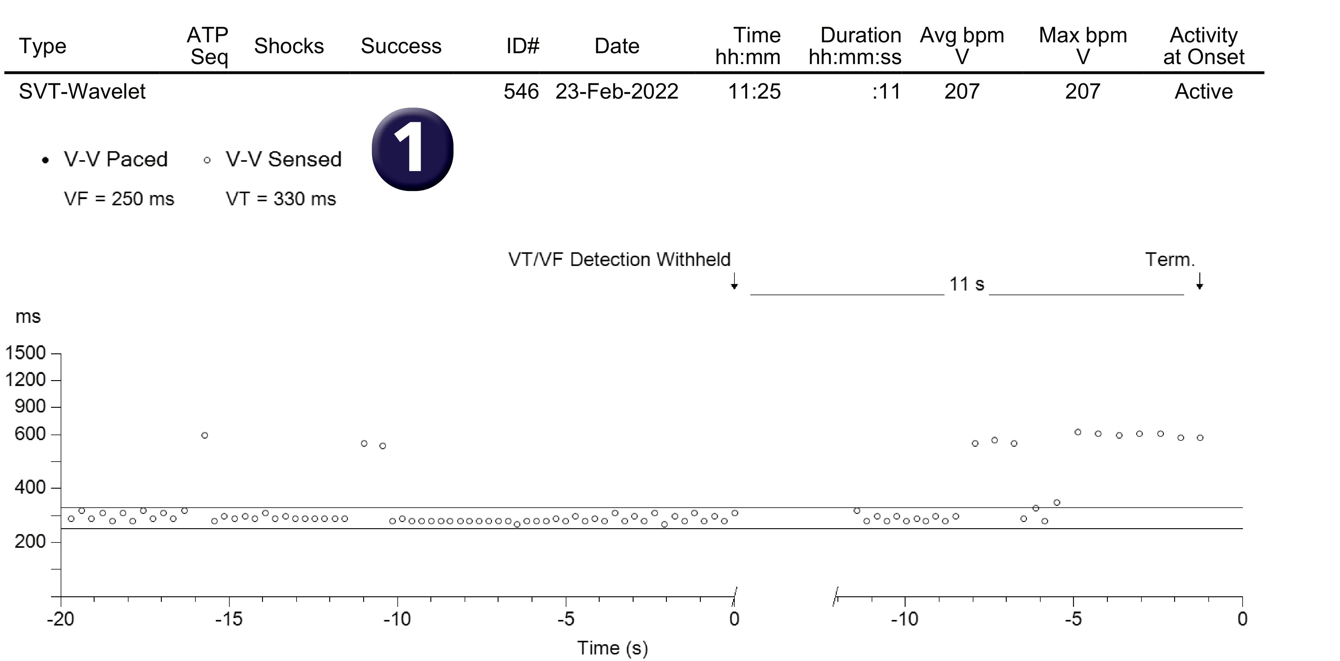 Medtronic ICD electrogram, segment 1 of 1 — The unexpected behaviour of an algorithm
