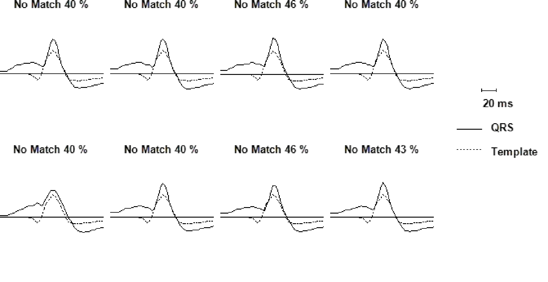 Wavelet overview