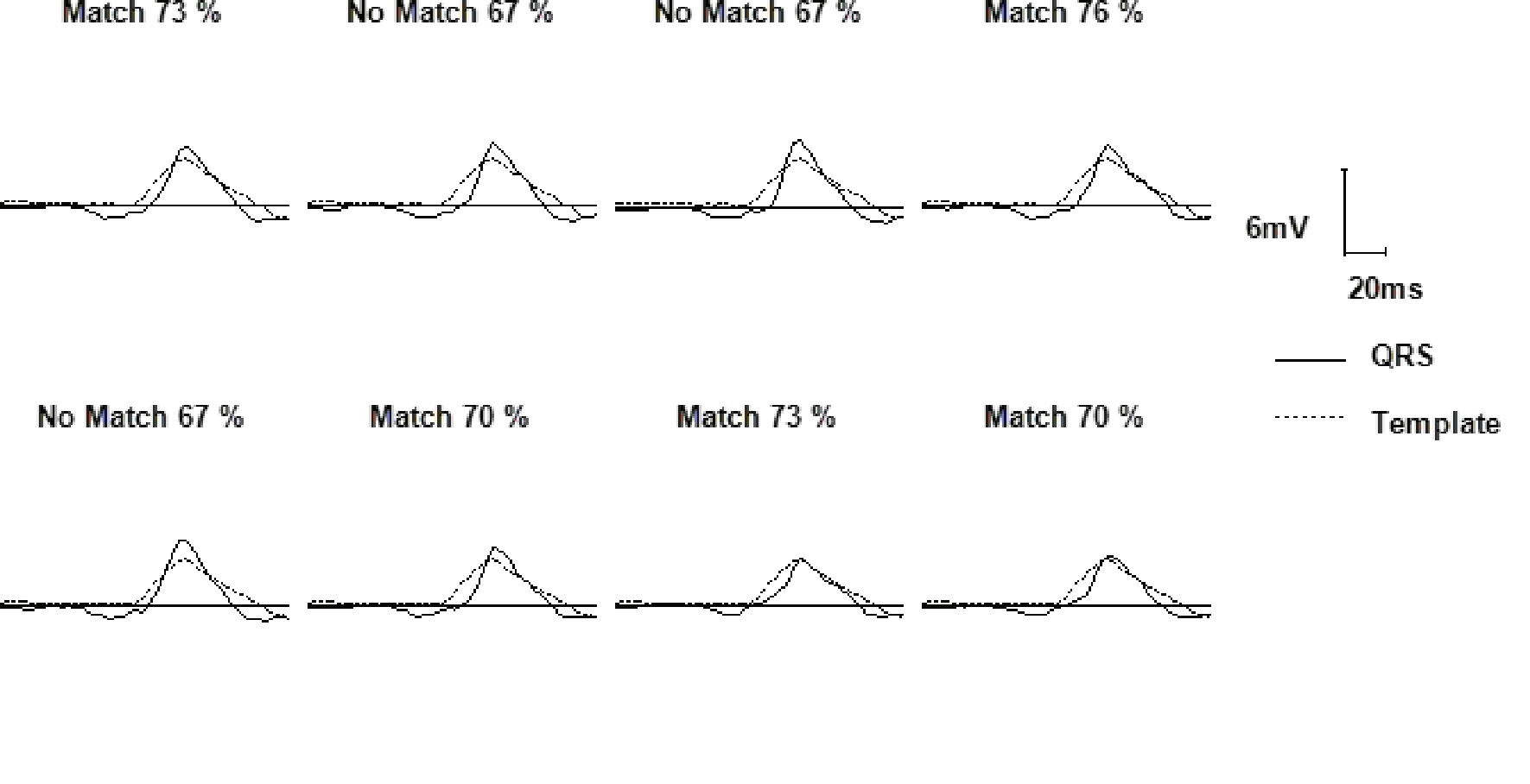 Wavelet overview