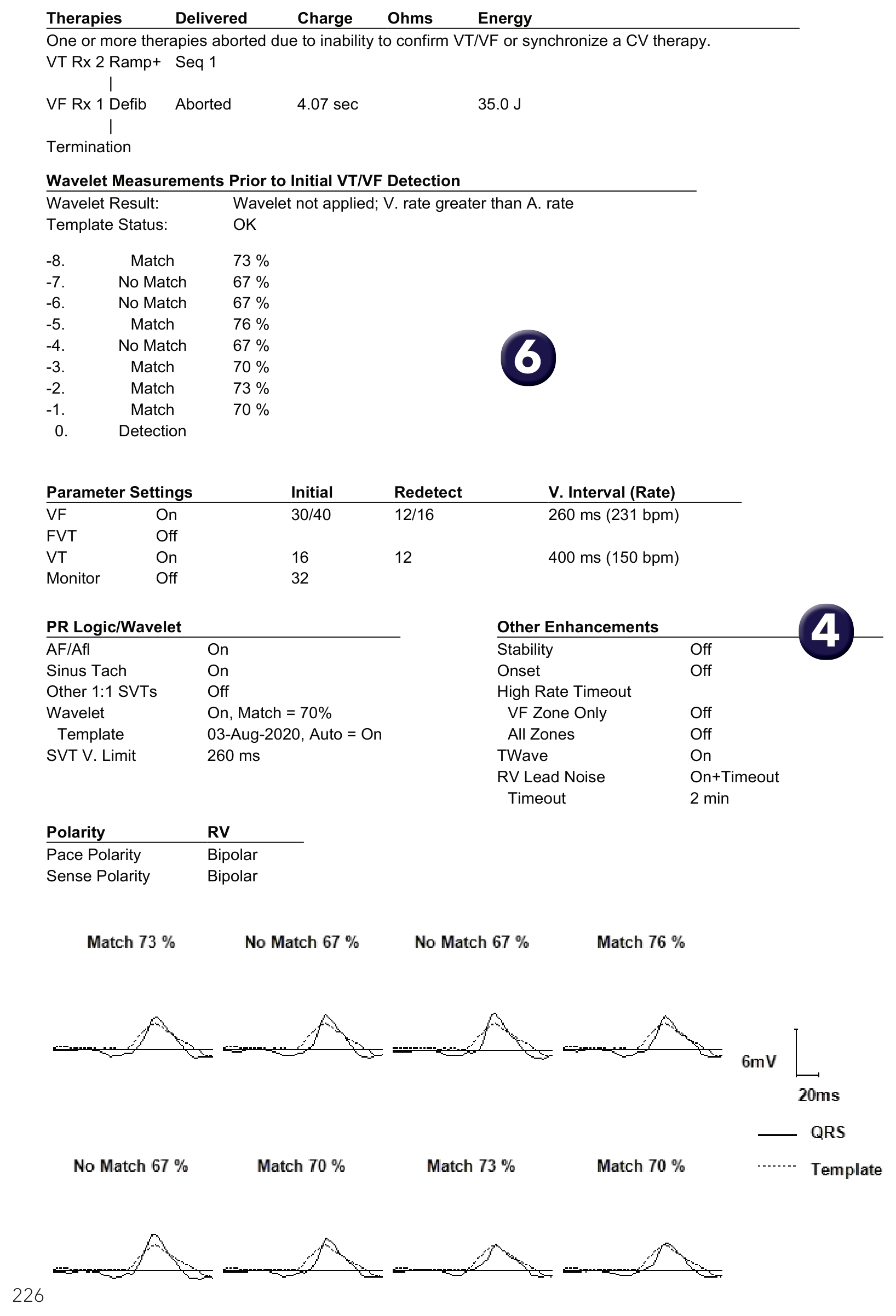 Medtronic ICD electrogram, segment 1 of 1 — PR Logic versus Wavelet