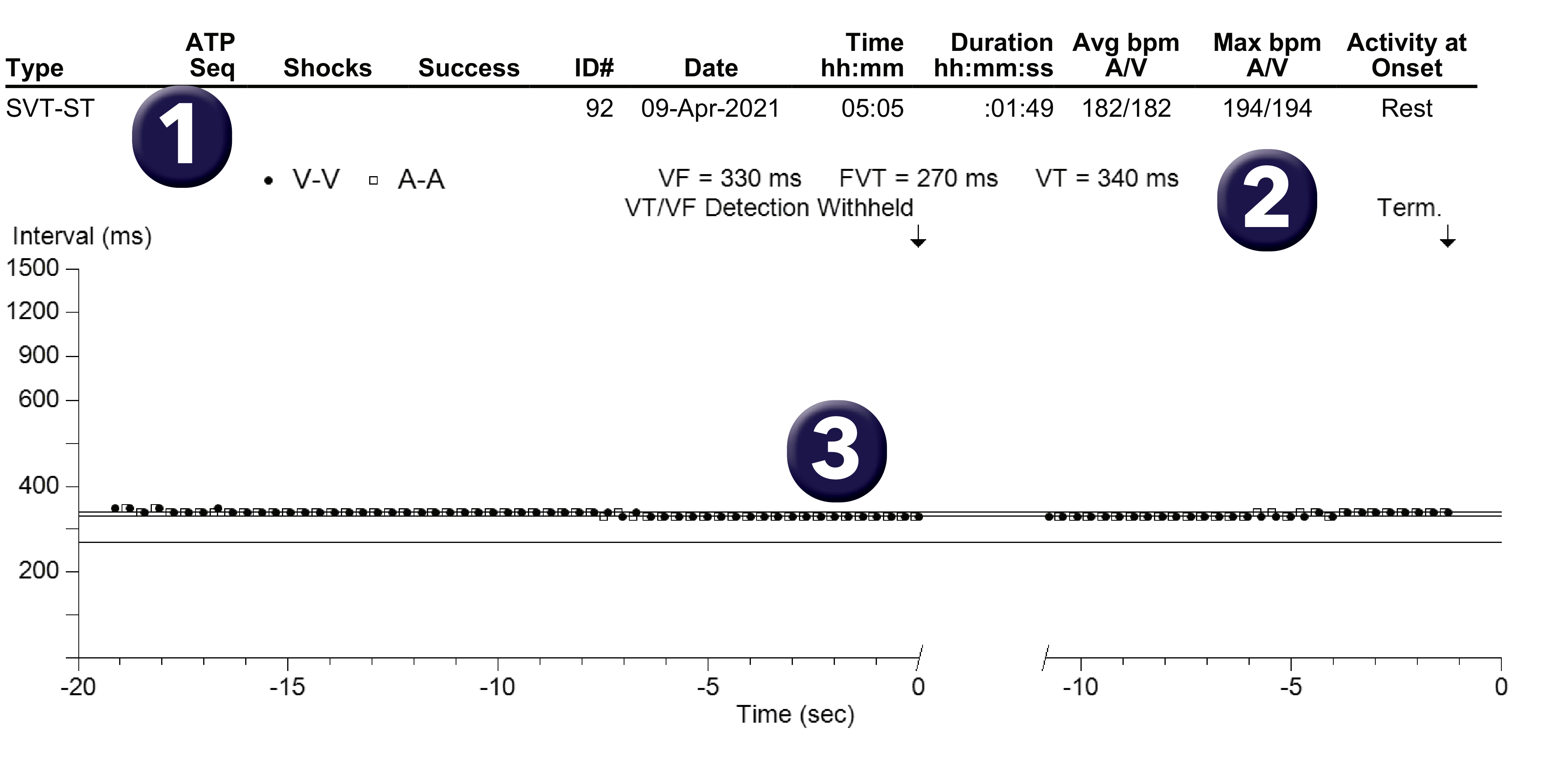 Medtronic ICD electrogram, segment 1 of 1 — Double-chamber discrimination and exertion in a young patient