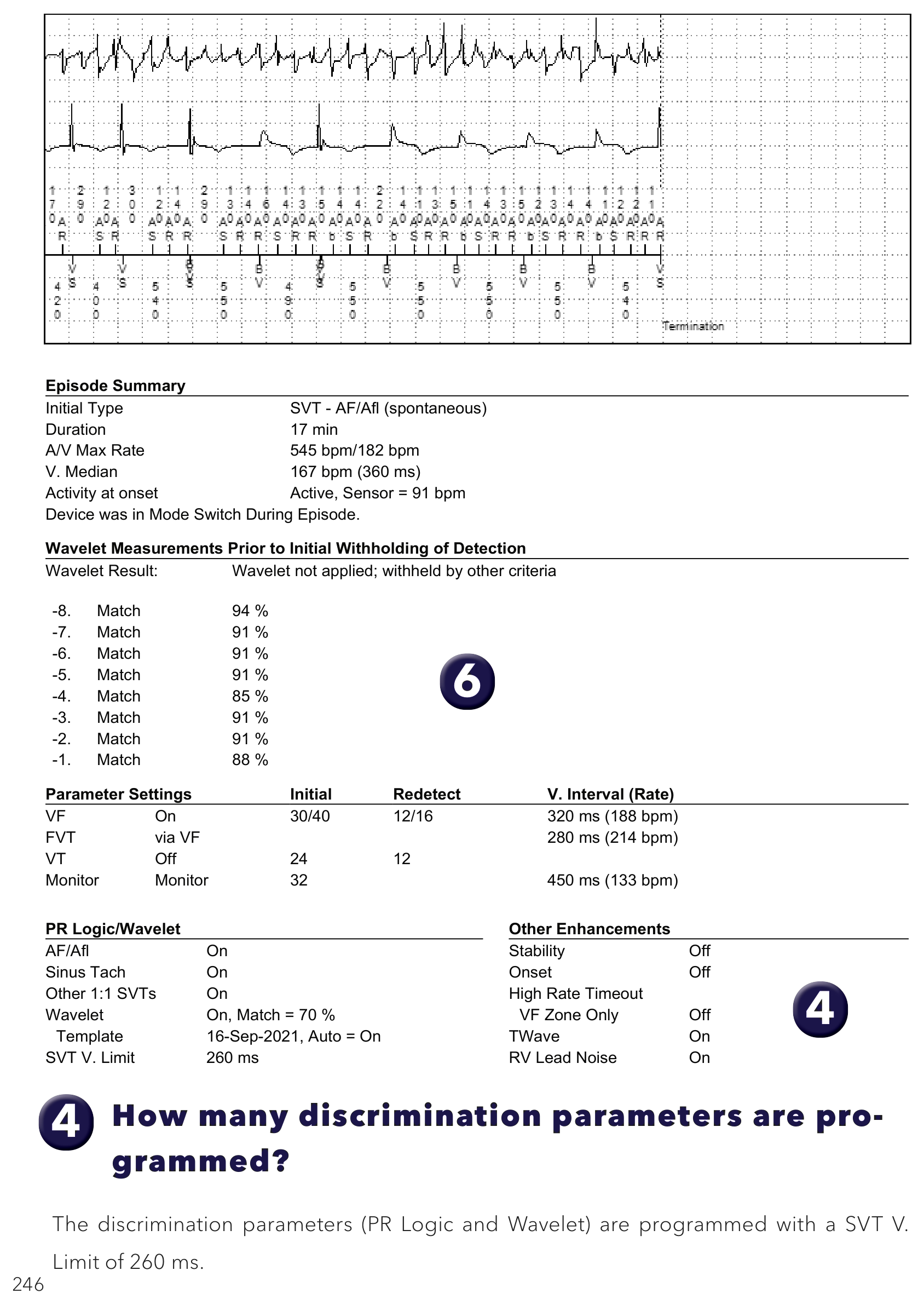 Medtronic ICD electrogram, segment 1 of 1 — PR Logic and conducted AF