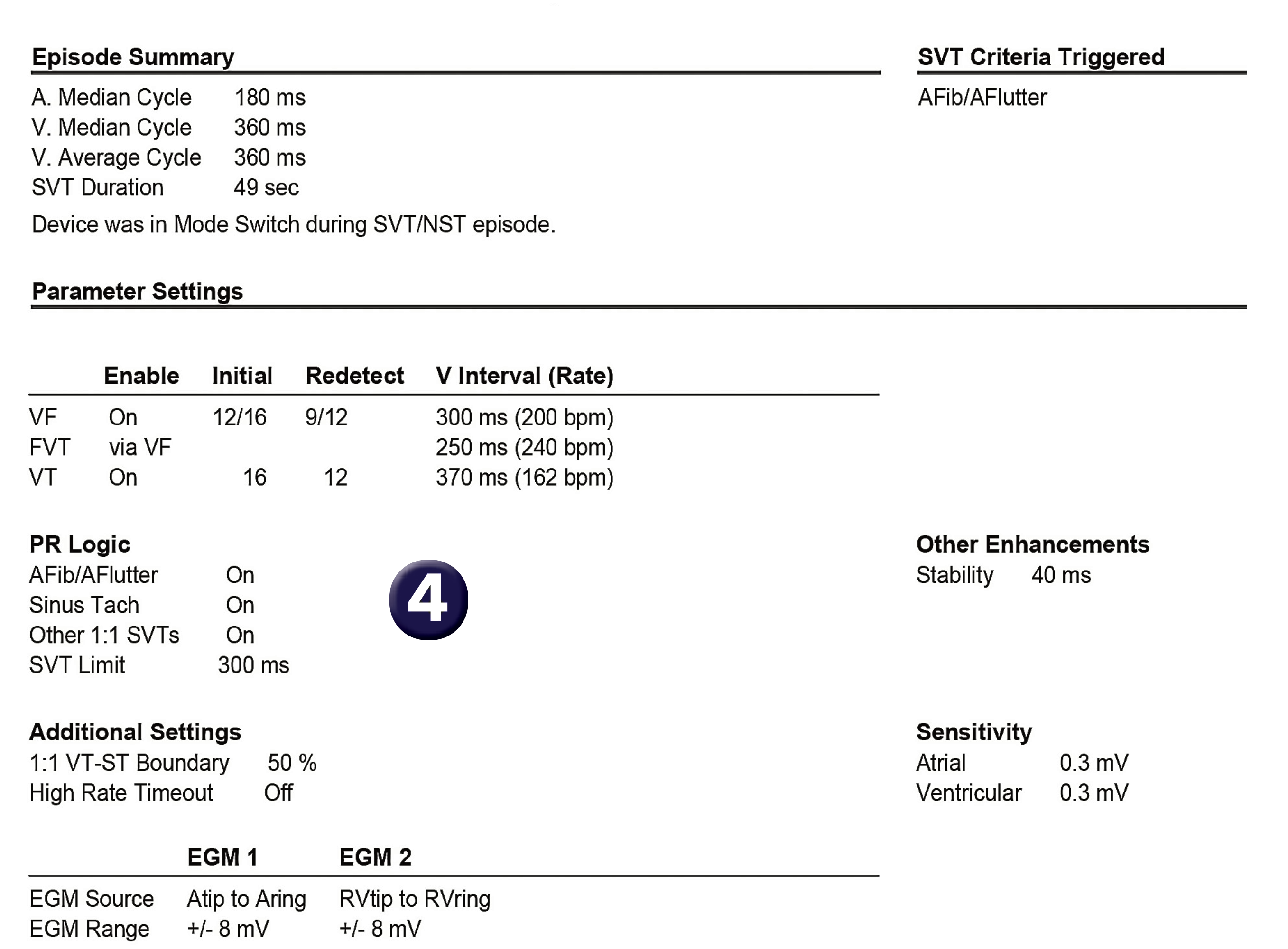 Medtronic ICD electrogram, segment 1 of 1 — PR Logic and atrial flutter