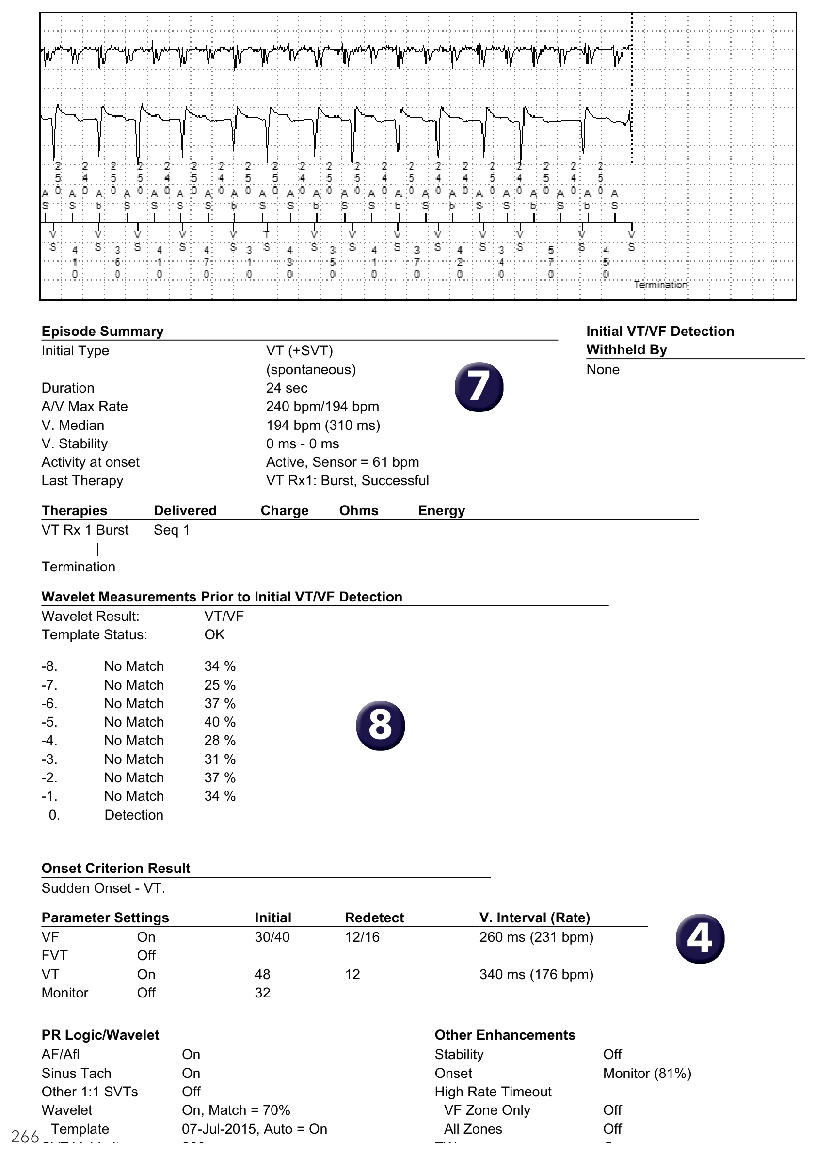 Medtronic ICD electrogram, segment 1 of 1 — Double-chamber discrimination and bi-tachycardia