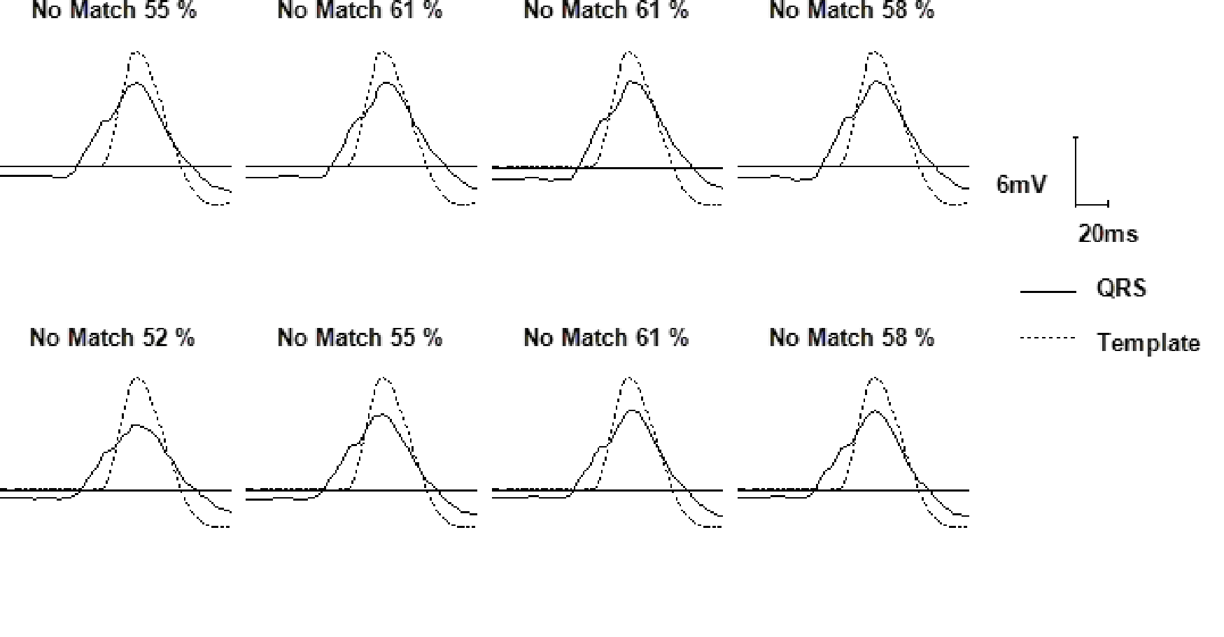 Wavelet overview