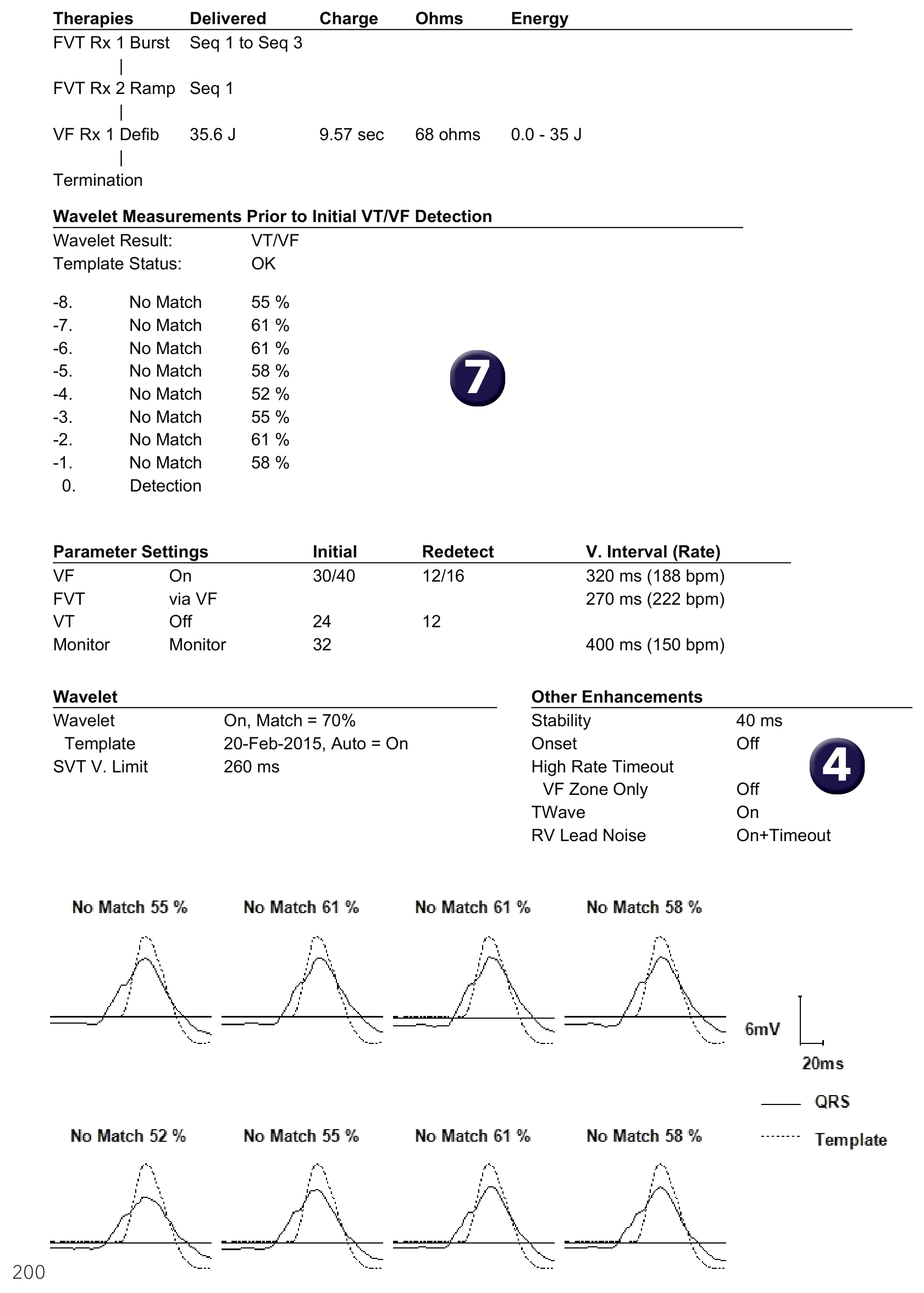 Medtronic ICD electrogram, segment 1 of 1 — Limitations of discrimination based on Wavelet