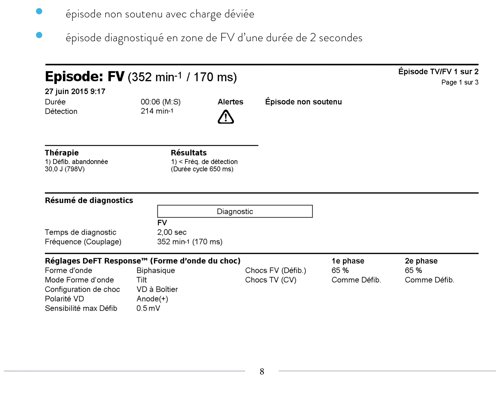 Classification des cycles, compteurs de tachycardie et évolution des recommandations