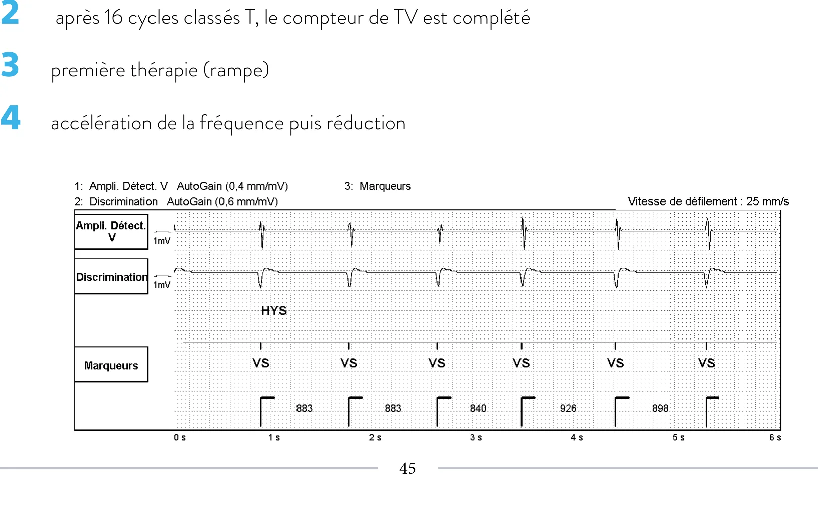 Nouvelles recommandations et nombre de cycles en détection initiale