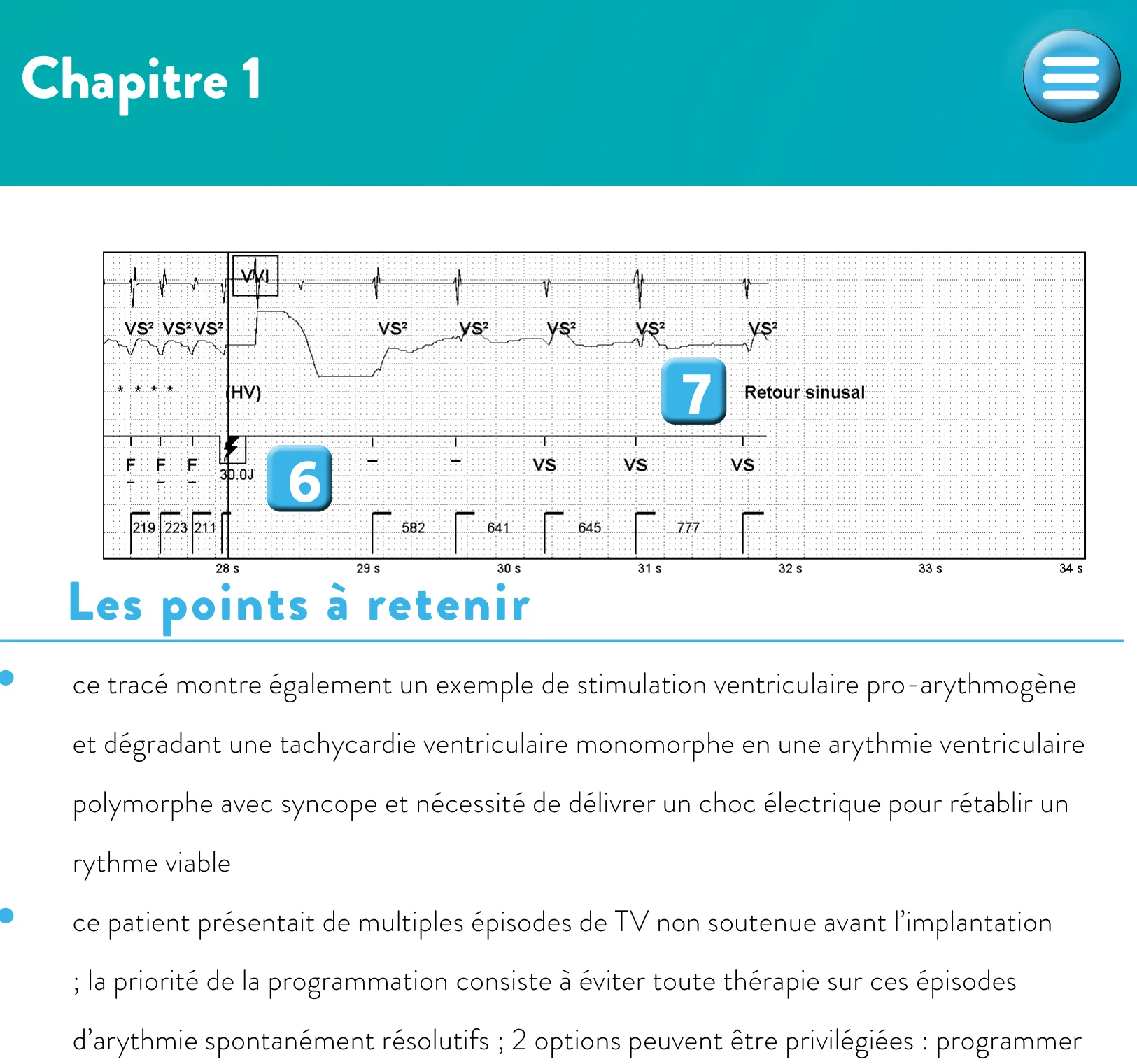 Nouvelles recommandations et nombre de cycles en détection initiale